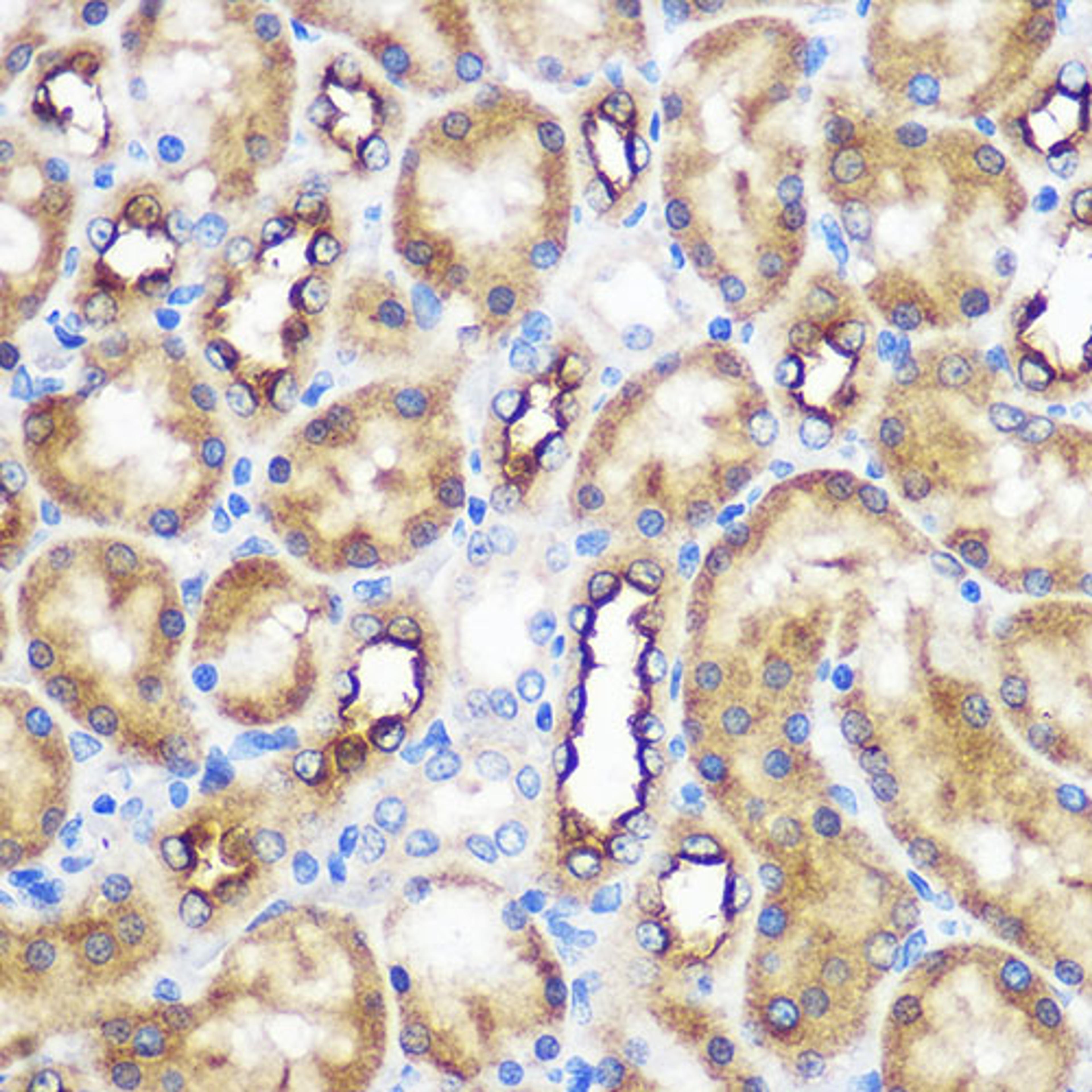 Immunohistochemistry  - WWC2 Rabbit pAb (A18668)