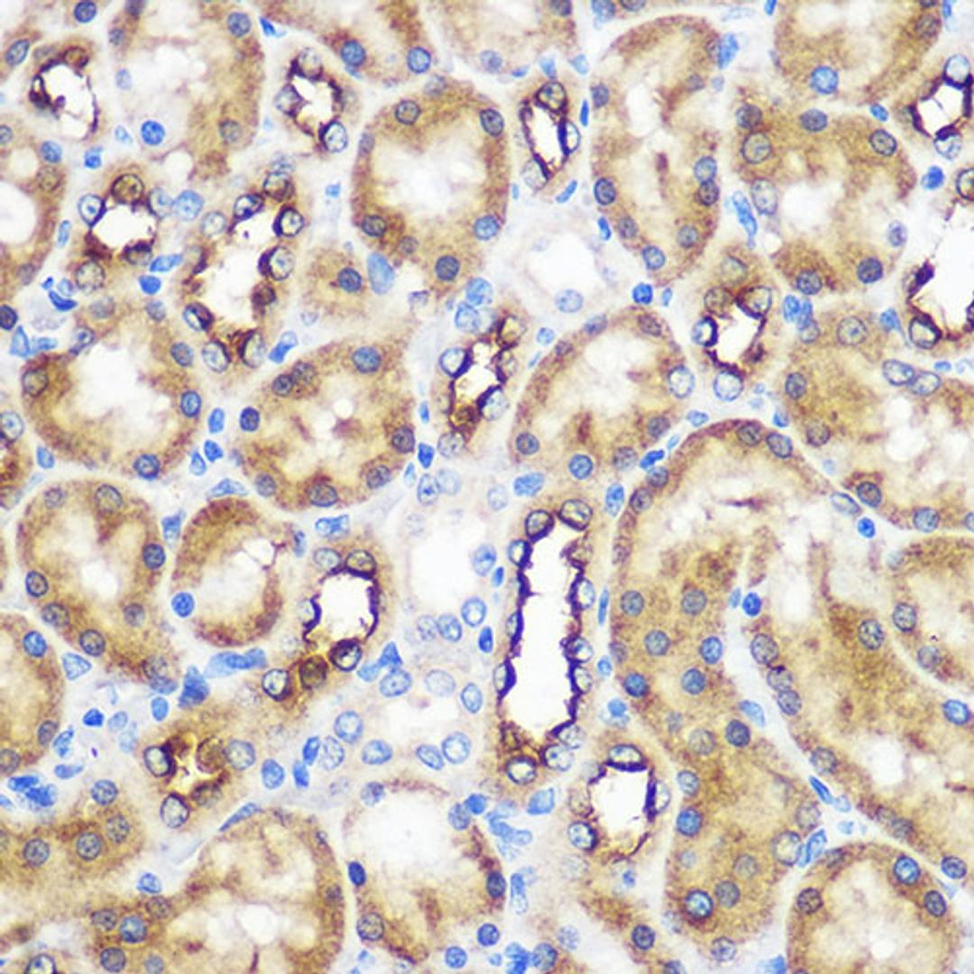 Immunohistochemistry - WWC2 Rabbit pAb (A18668)