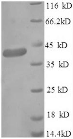 (Tris-Glycine gel) Discontinuous SDS-PAGE (reduced) with 5% enrichment gel and 15% separation gel.