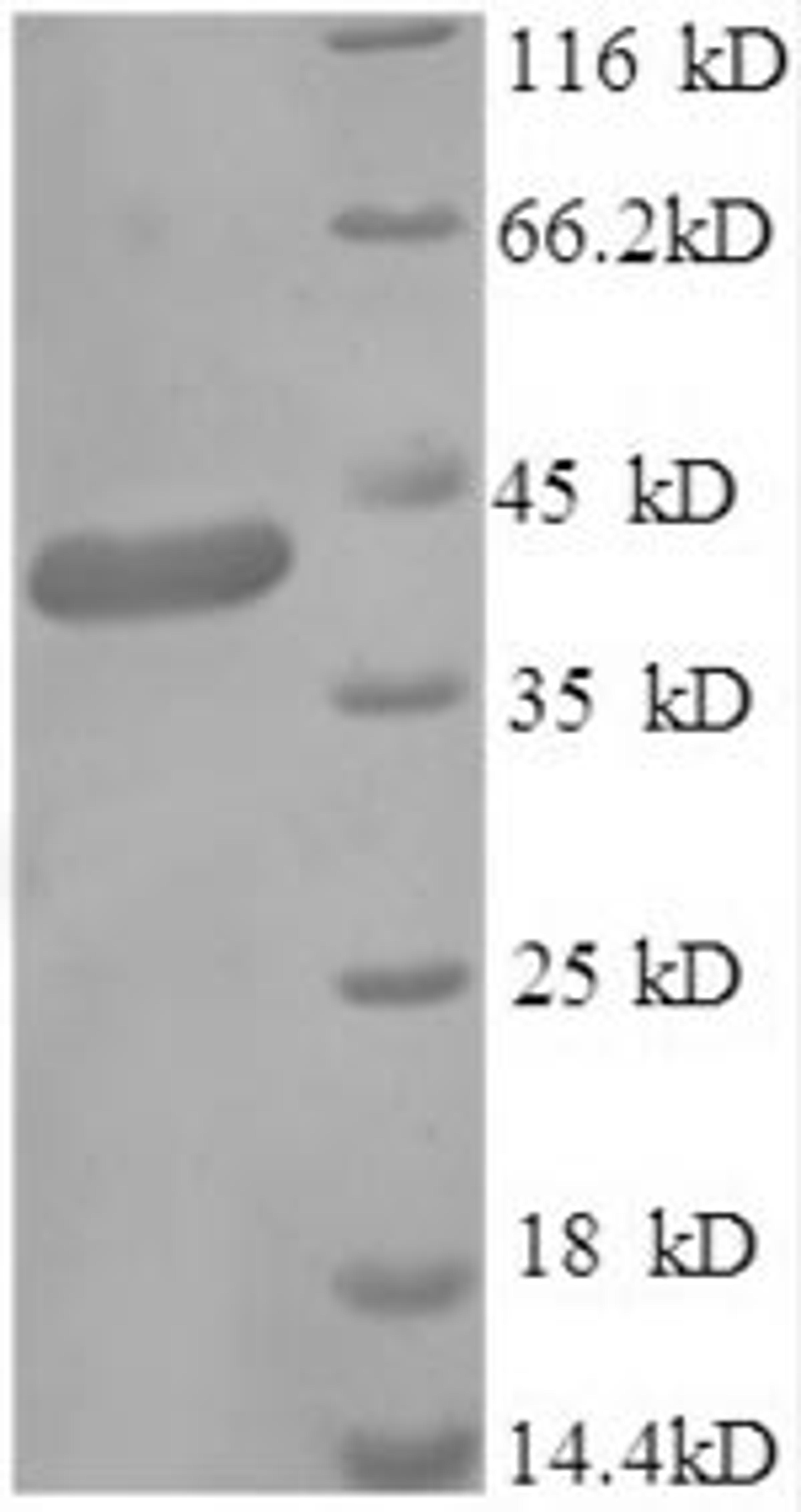 (Tris-Glycine gel) Discontinuous SDS-PAGE (reduced) with 5% enrichment gel and 15% separation gel.