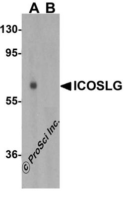 Western blot analysis of ICOSLG in human lymph node tissue lysate with ICOSLG antibody at 1 μg/mL in (A) the absence and (B) the presence of blocking peptide.