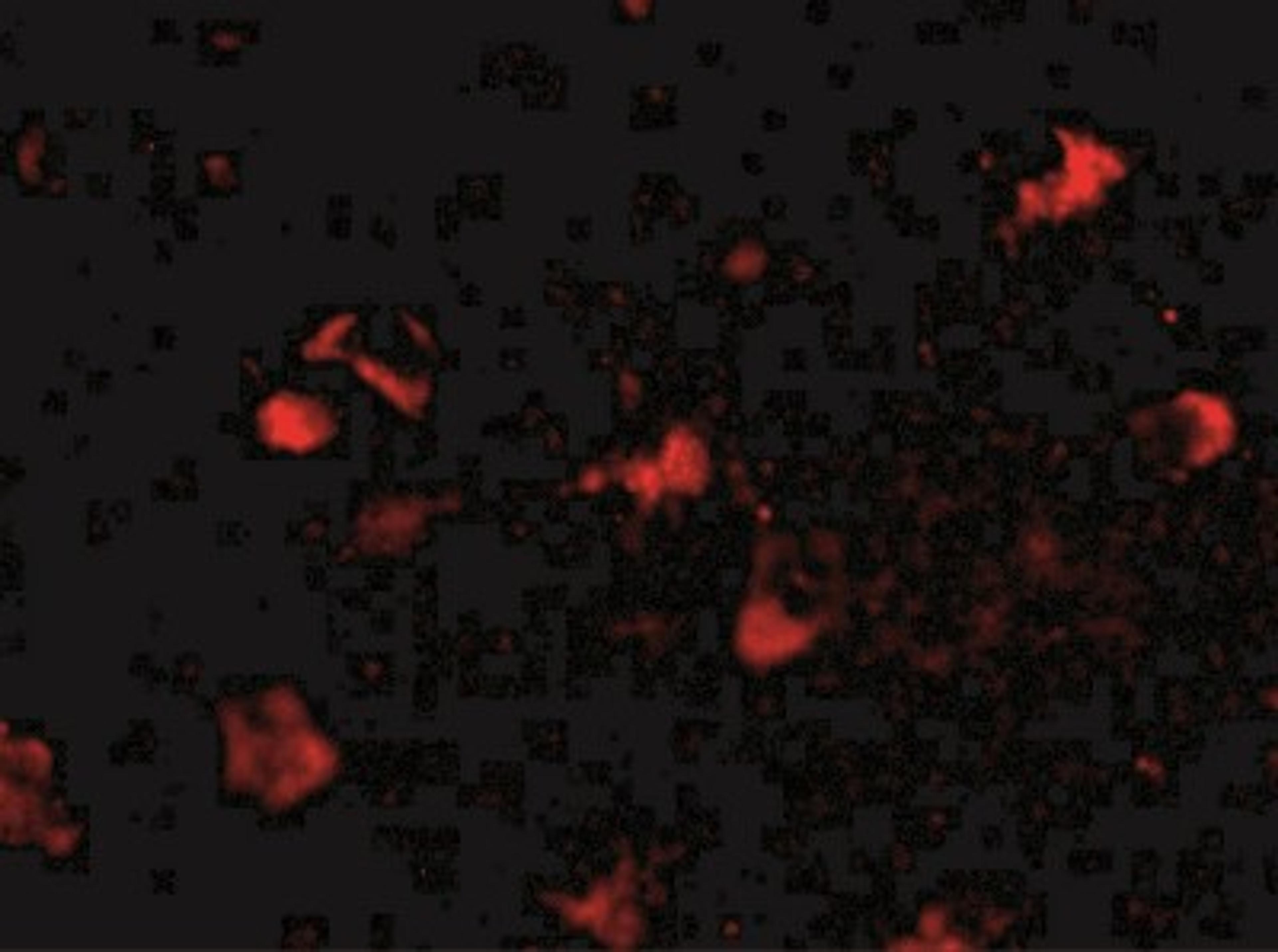 Immunocytochemistry/Immunofluorescence: MEX3A Antibody [NBP2-41092] - Immunofluorescence of rkhd4 in human brain tissue with rkhd4 antibody at 20 ug/mL.