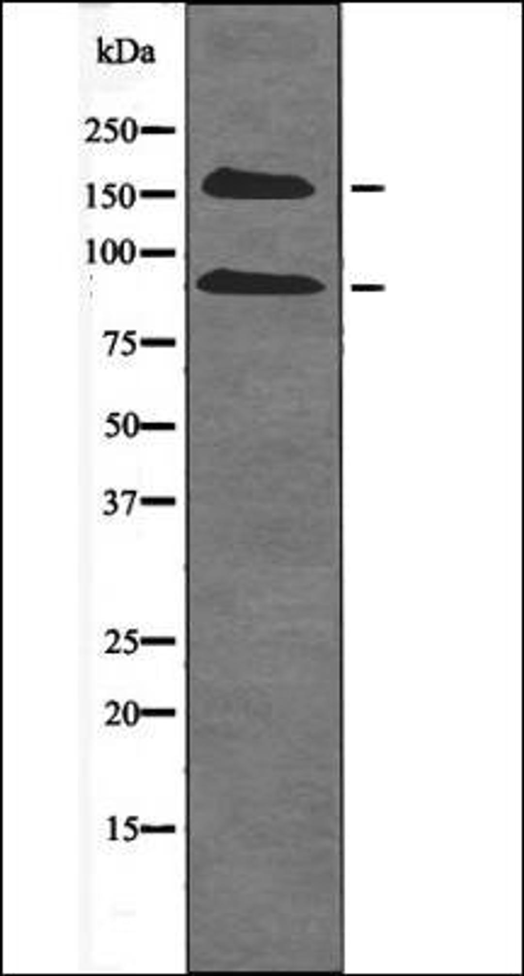 Western blot analysis of Na2VO3 treated HepG2 whole cell lysates using IGF1R -Phospho-Tyr980- antibody