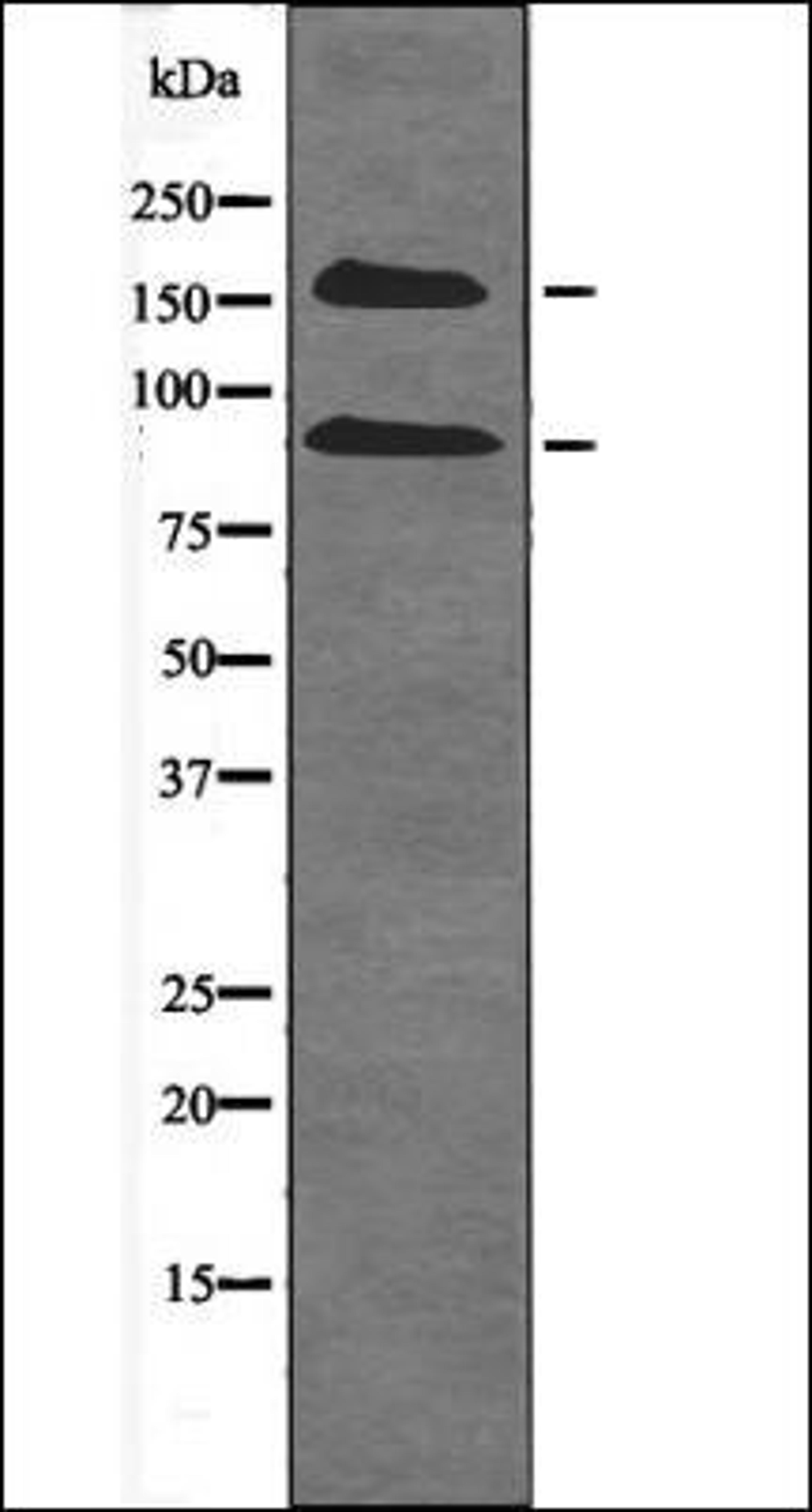 Western blot analysis of Na2VO3 treated HepG2 whole cell lysates using IGF1R -Phospho-Tyr980- antibody