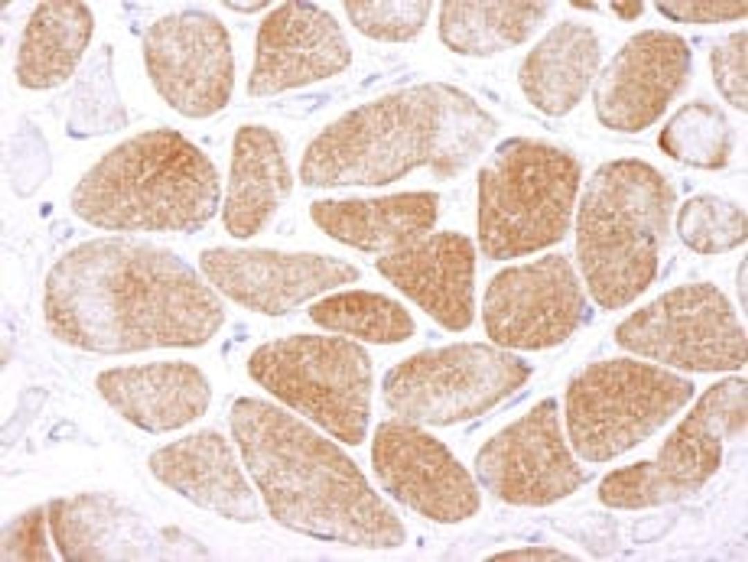 Detection of human AMPK alpha 1 by immunohistochemistry.