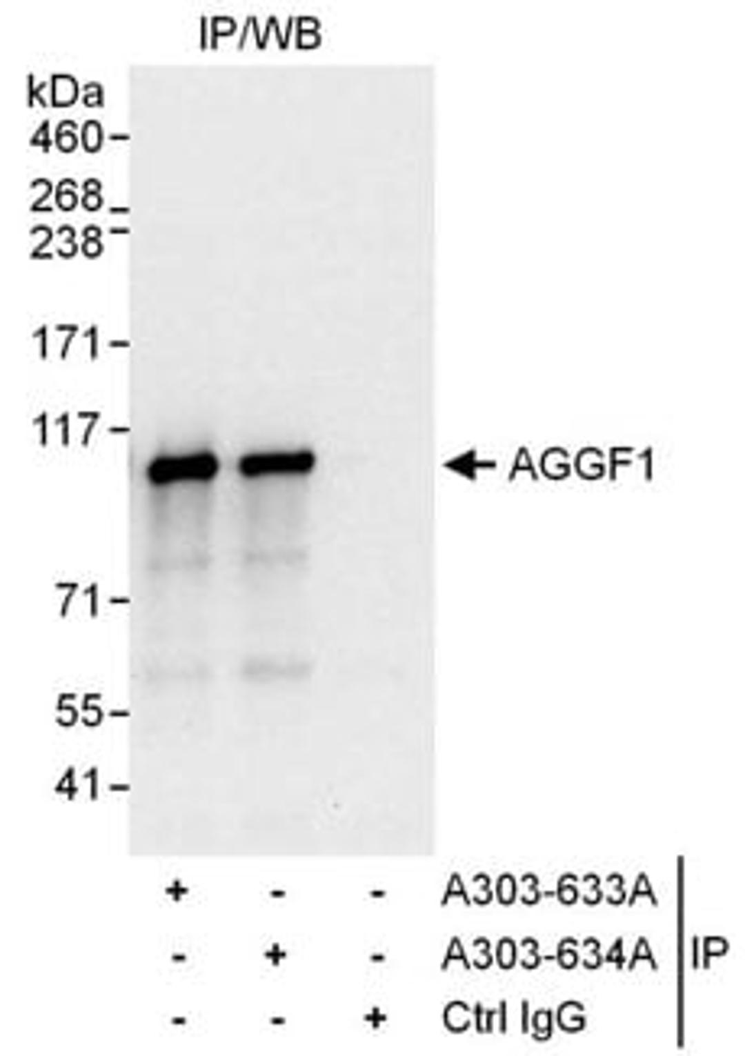 Detection of human AGGF1 by western blot of immunoprecipitates.