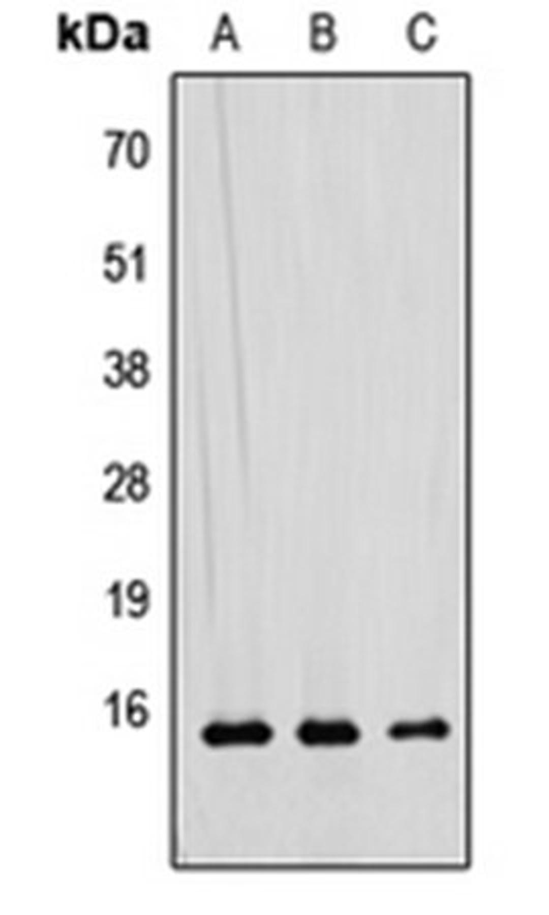 Western blot analysis of HEK293T (Lane 1), Raw264.7 (Lane 2), H9C2 (Lane 3) whole cell lysates using RAD52B antibody