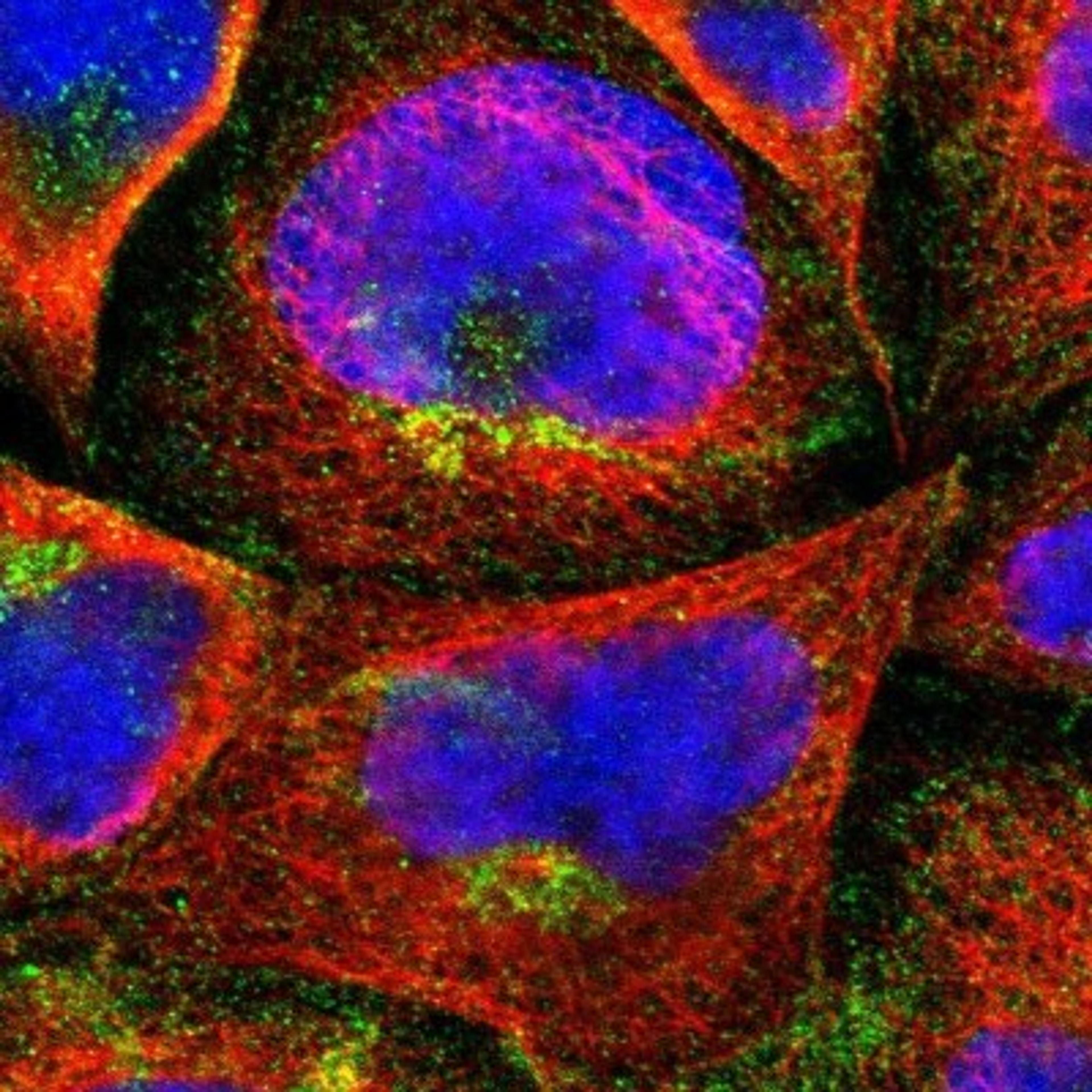 Immunocytochemistry/Immunofluorescence: Periaxin Antibody [NBP1-89598] - Staining of human cell line A-431 shows positivity in golgi apparatus & vesicles.