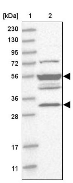 Western Blot: TMPPE Antibody [NBP1-93749] - Lane 1: Marker [kDa] 230, 130, 95, 72, 56, 36, 28, 17, 11<br/>Lane 2: Human cell line RT-4