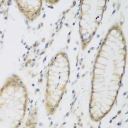 Immunohistochemical staining of rat kidney tissue using NAT8B antibody (dilution of 1:200)