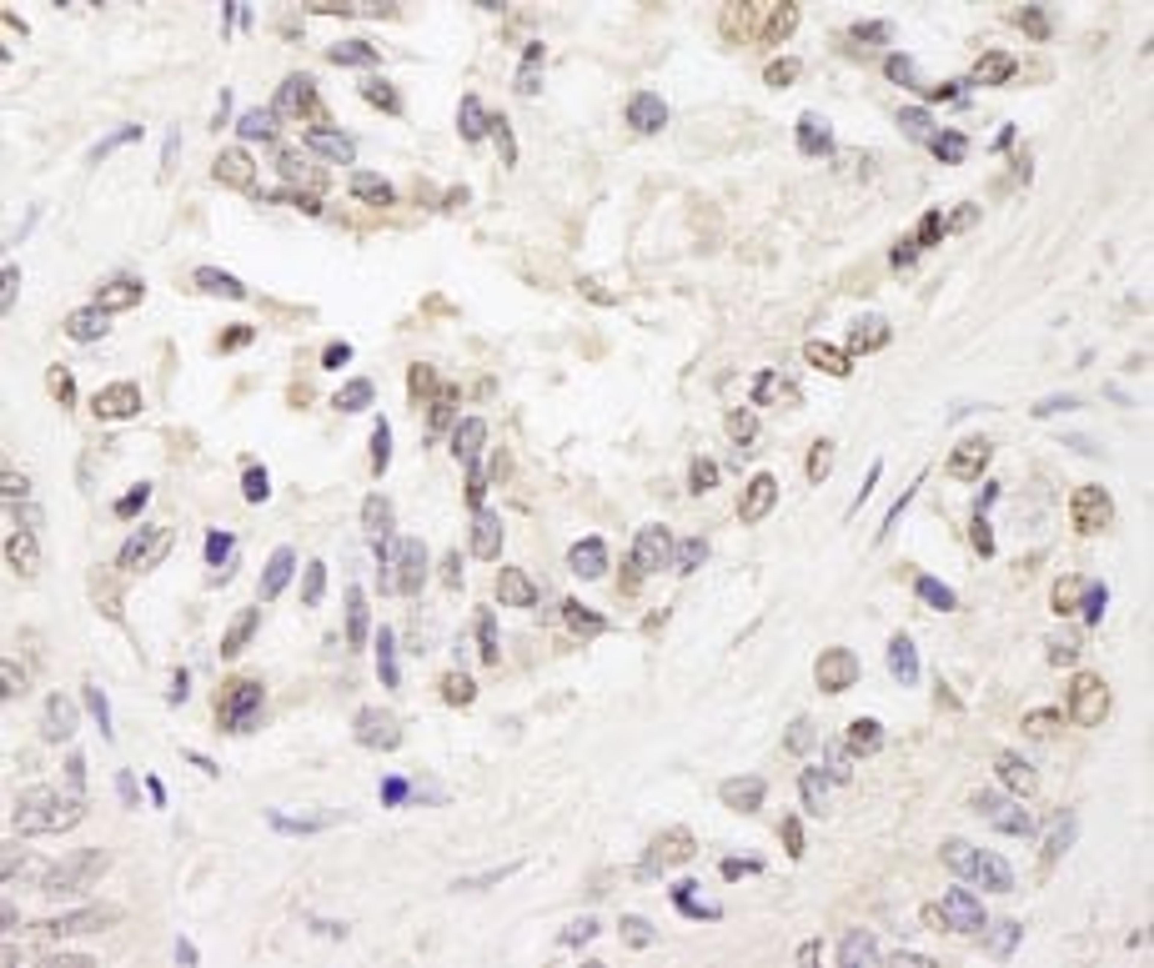 Detection of human FOG1/ZFPM1 by immunohistochemistry.