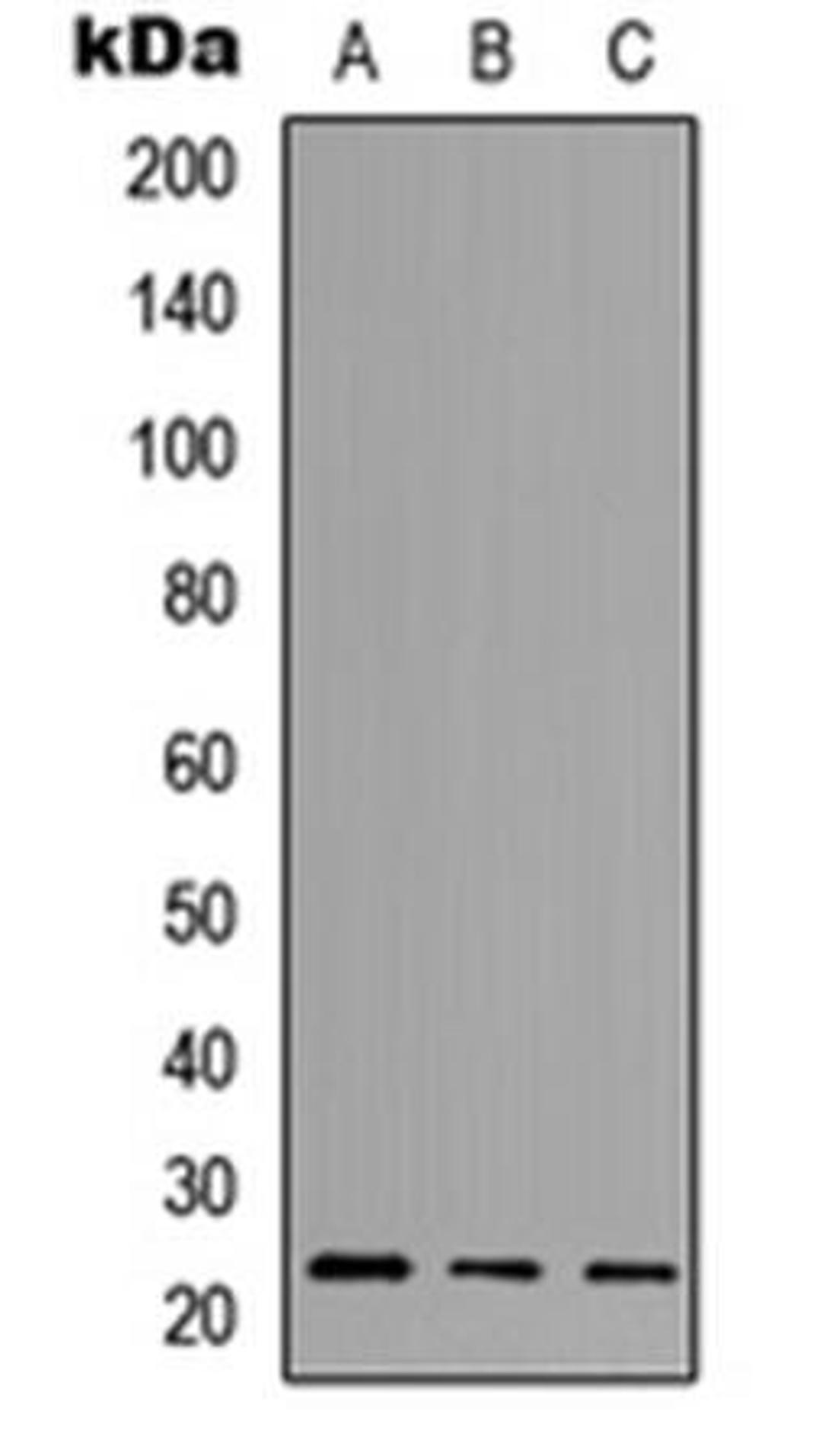 Western blot analysis of HeLa (Lane1), NS-1 (Lane2), H9C2 (Lane3) whole cell using NCALD antibody