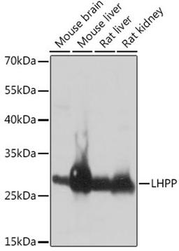 Western blot - LHPP antibody (A14342)