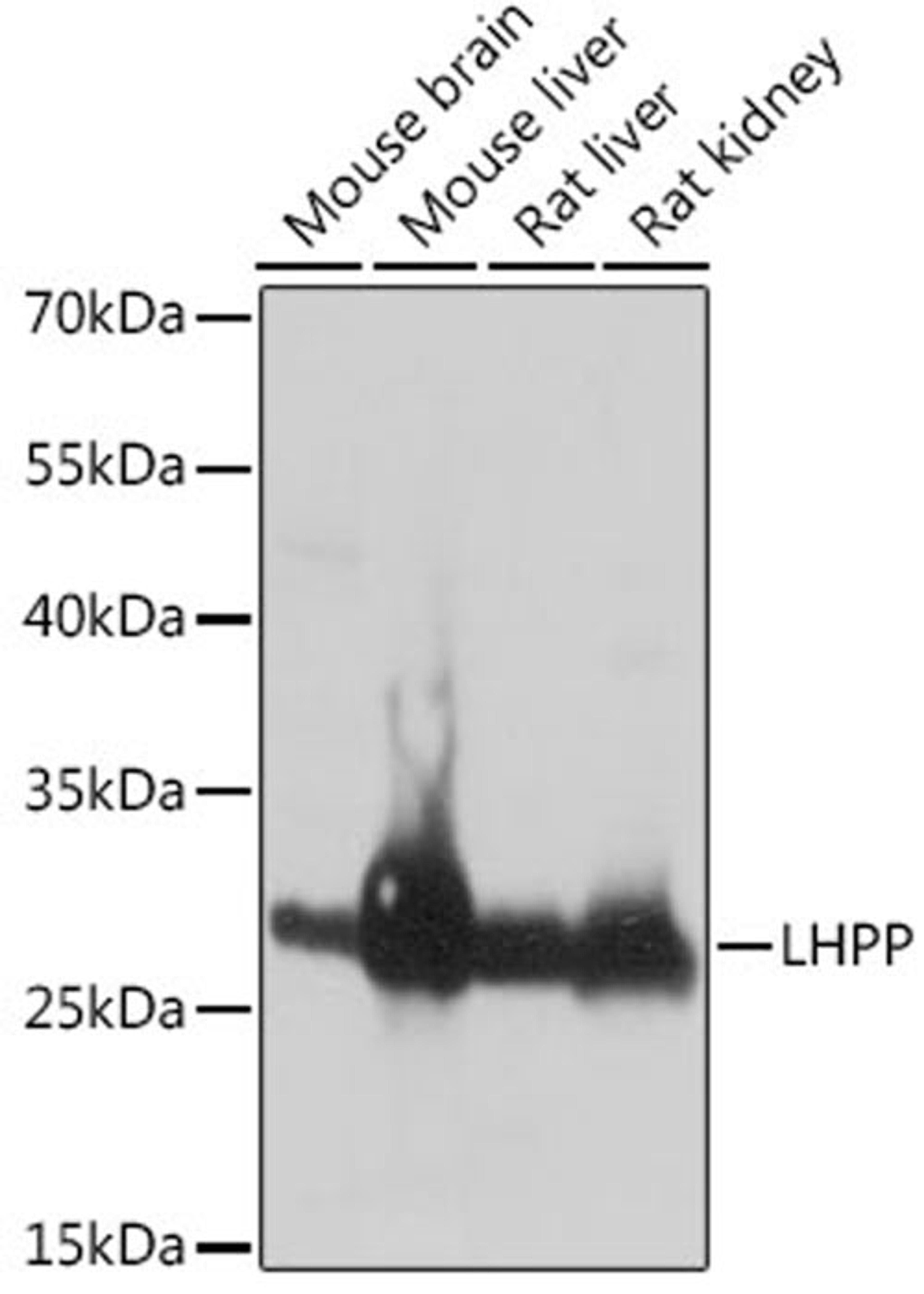 Western blot - LHPP antibody (A14342)