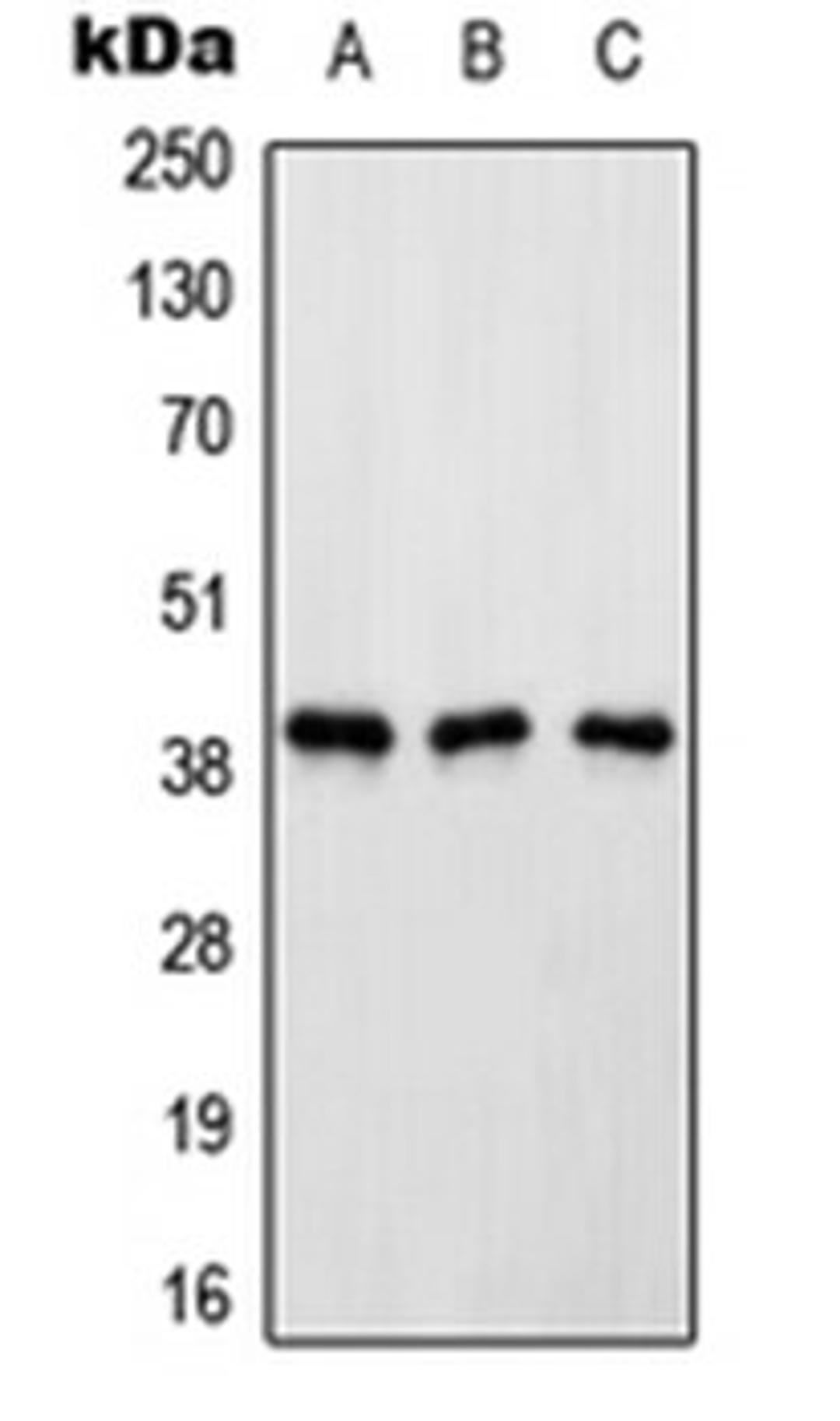 Western blot analysis of HeLa (Lane 1), Raw264.7 (Lane 2), rat kidney (Lane 3) whole cell lysates using ATP6AP2 antibody