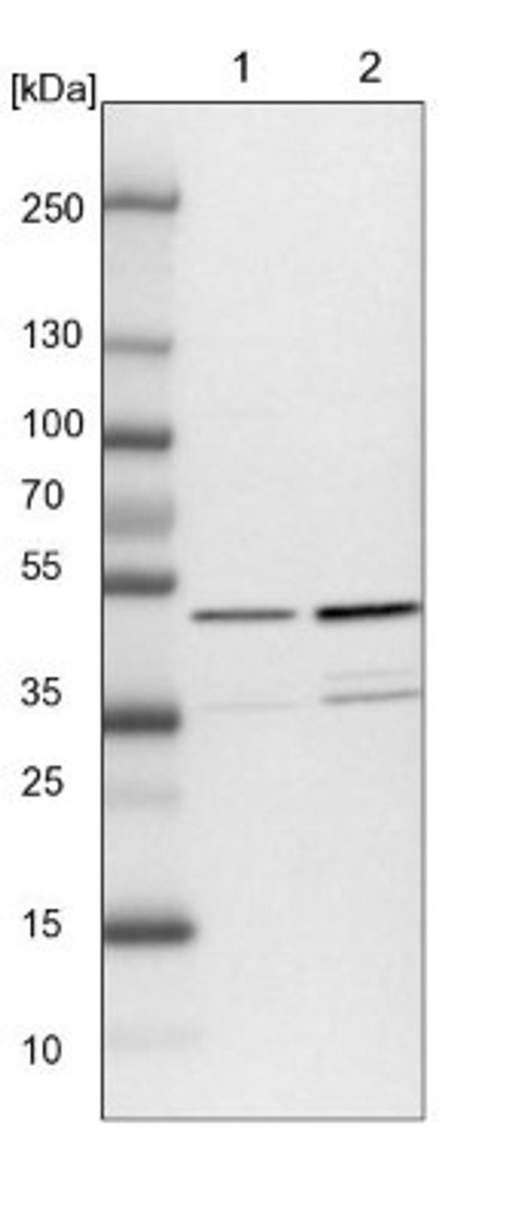 Western Blot: NUDC Antibody [NBP1-89517] - Lane 1: NIH-3T3 cell lysate (Mouse embryonic fibroblast cells)<br/>Lane 2: NBT-II cell lysate (Rat Wistar bladder tumour cells)