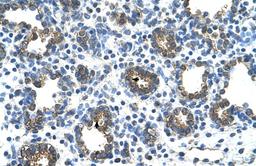 Antibody used in IHC on Human Lung.