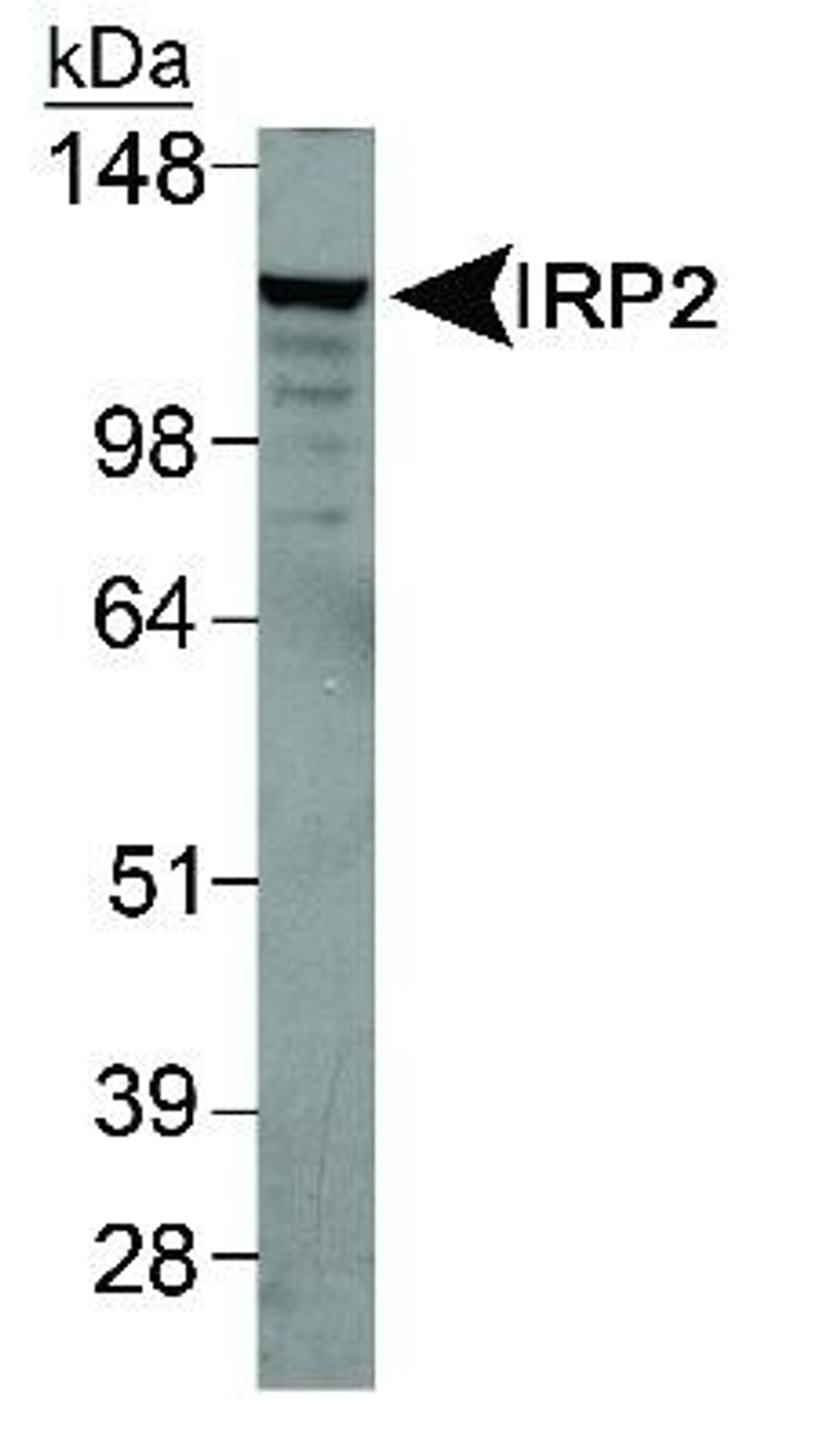 Western Blot: IRP2 Antibody [NB100-1798] - Detection of IRP2 in mouse liver lysate.