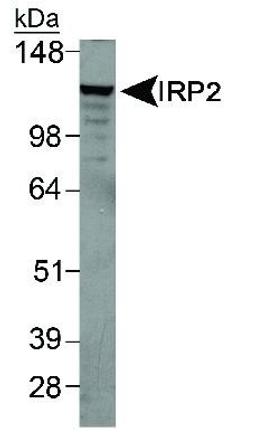 Western Blot: IRP2 Antibody [NB100-1798] - Detection of IRP2 in mouse liver lysate.