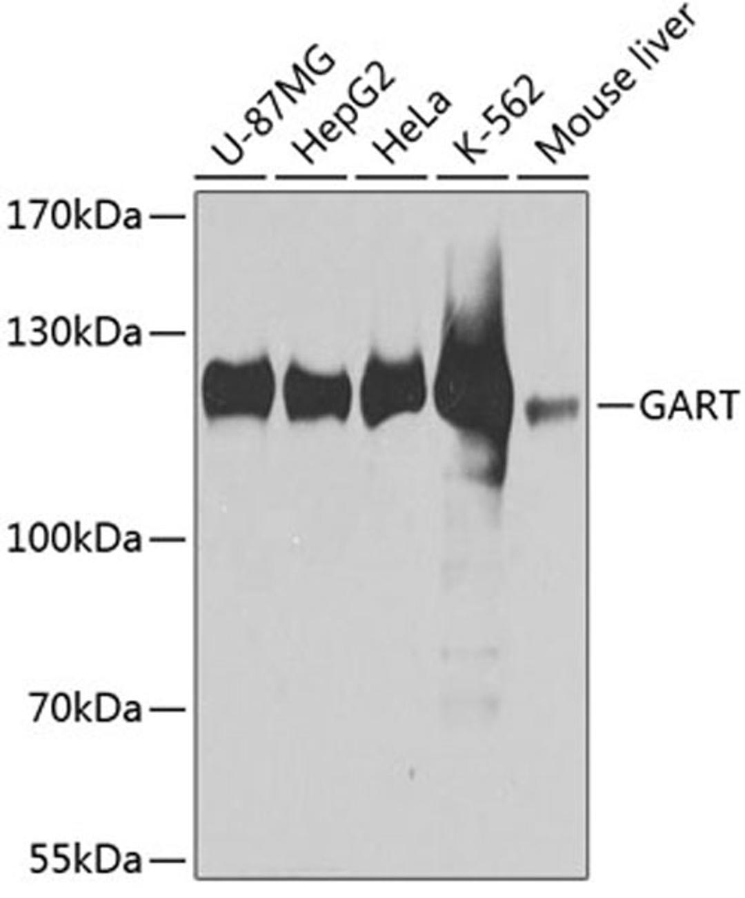 Western blot - GART antibody (A3876)