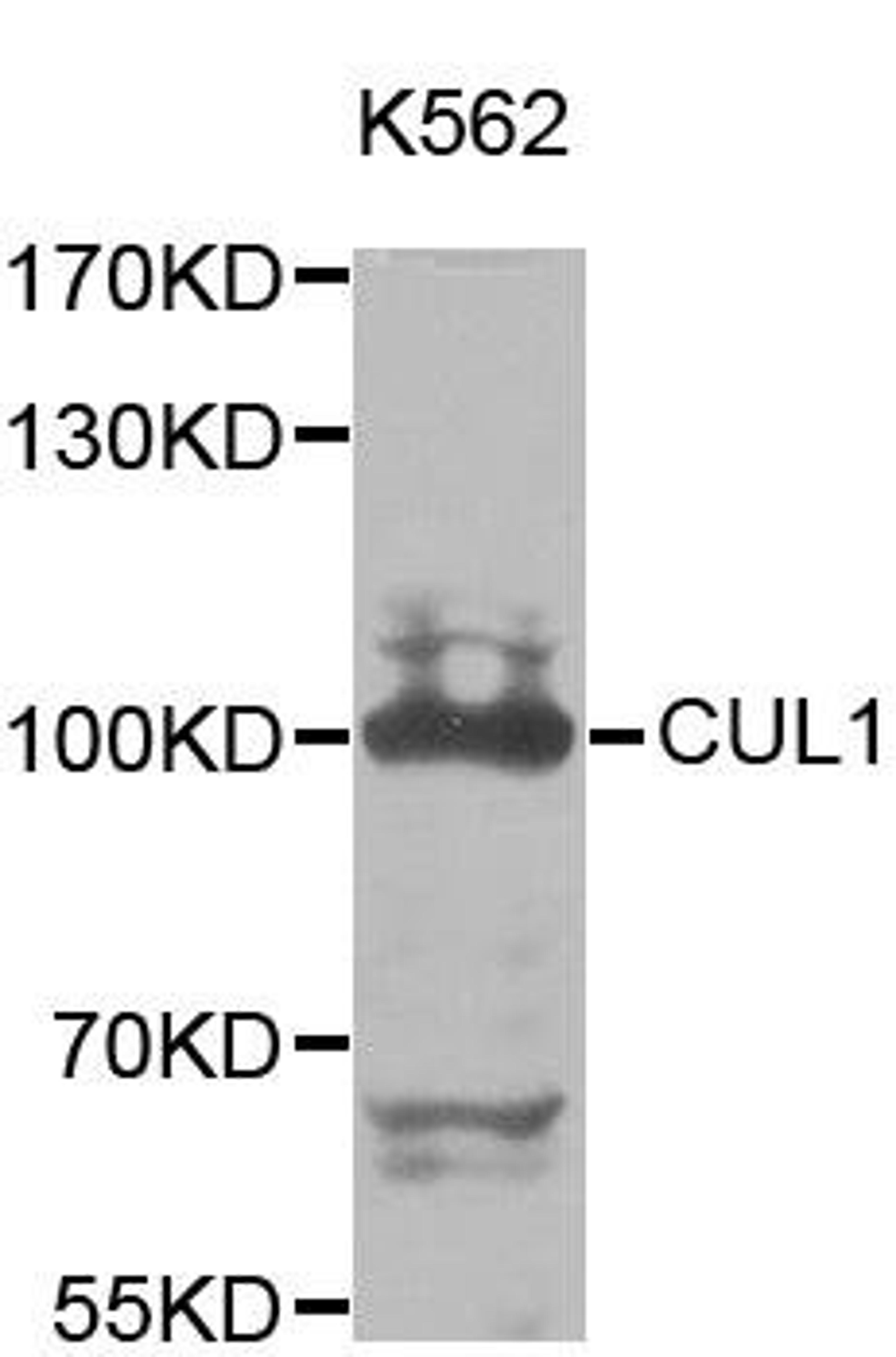 Western blot analysis of extracts of K562 cell line using CUL1 antibody