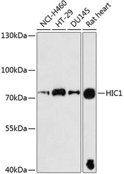 Western blot - HIC1 antibody (A9651)