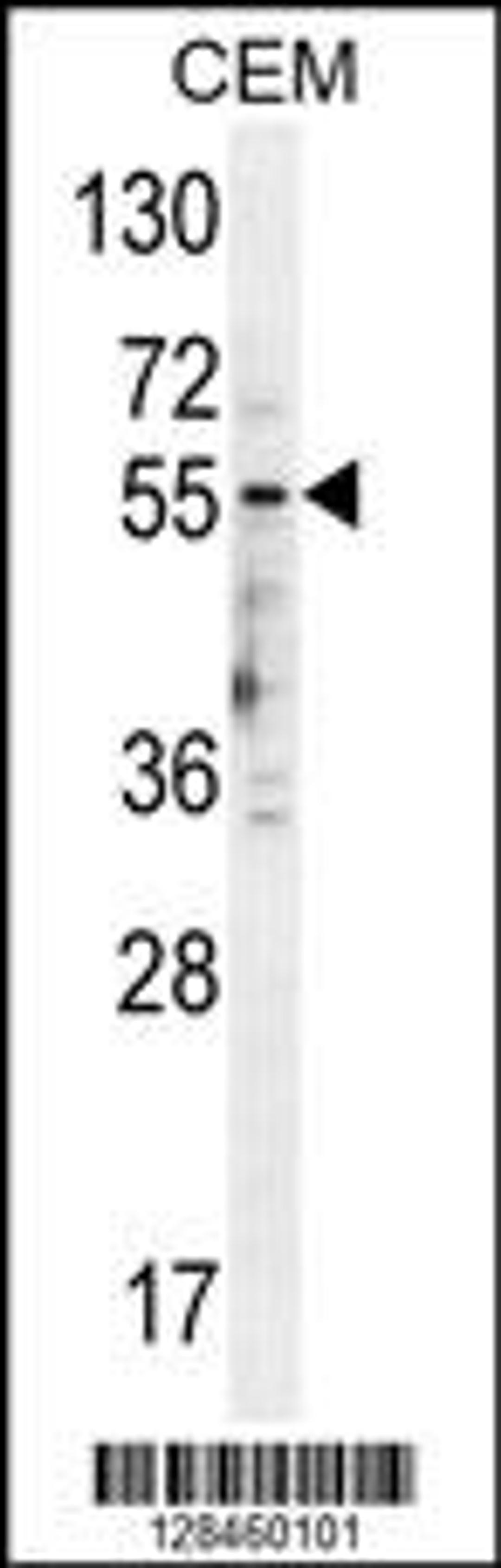 Western blot analysis in CEM cell line lysates (35ug/lane).