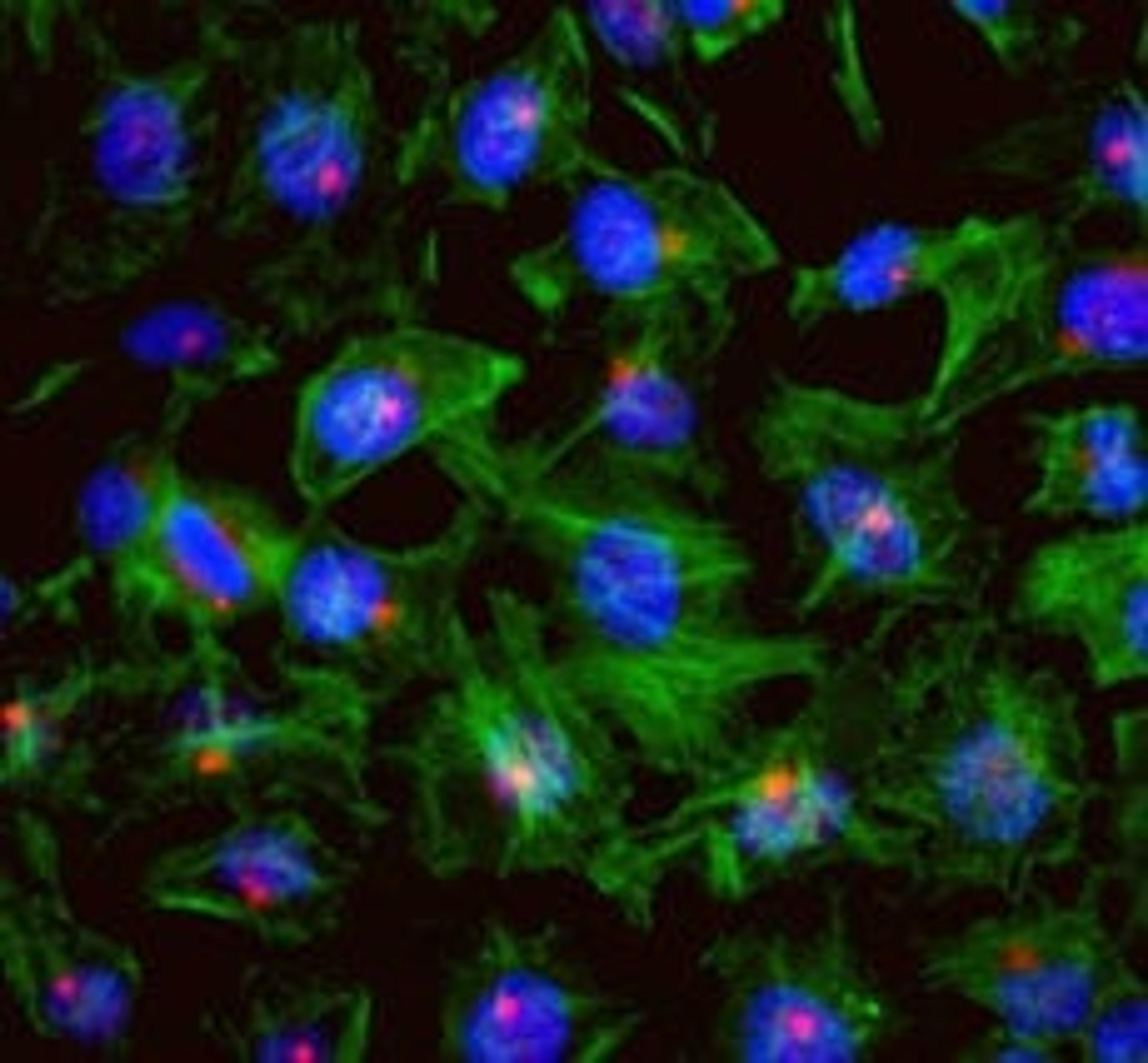 Detection of human CEP131/AZ1 by immunocytochemistry.