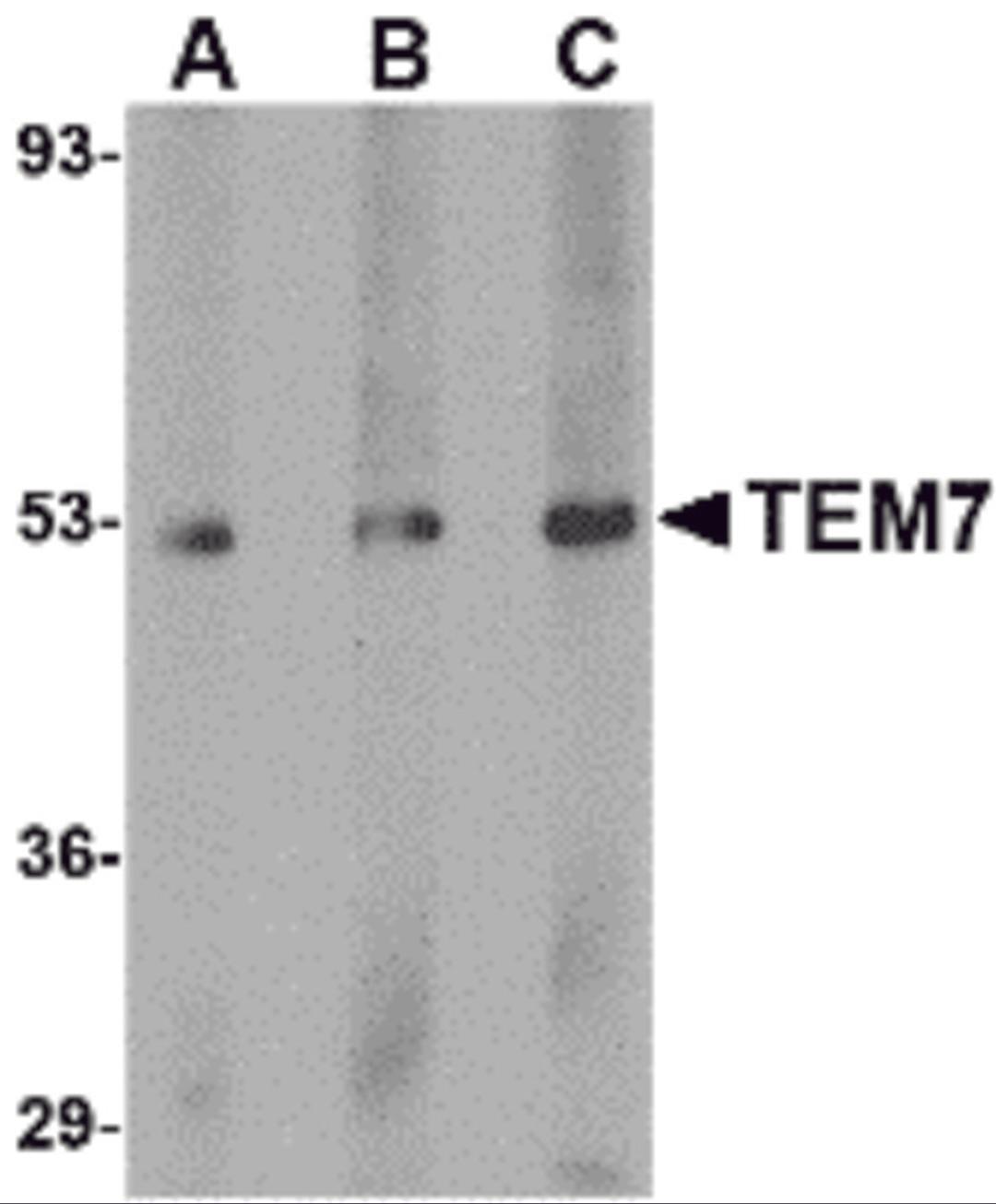 Western blot analysis of TEM7 in human liver tissue lysate with TEM7 antibody at (A) 0.5, (B) 1 and (C) 2 &#956;g/mL.