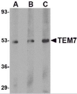 Western blot analysis of TEM7 in human liver tissue lysate with TEM7 antibody at (A) 0.5, (B) 1 and (C) 2 &#956;g/mL.