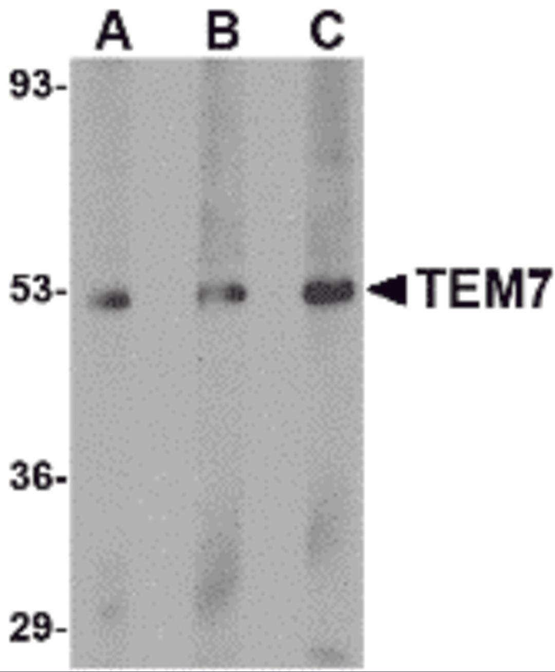 Western blot analysis of TEM7 in human liver tissue lysate with TEM7 antibody at (A) 0.5, (B) 1 and (C) 2 μg/mL.