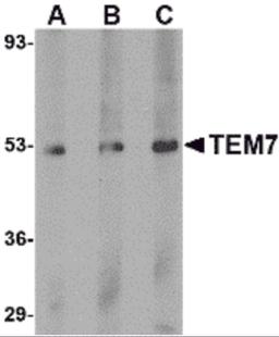 Western blot analysis of TEM7 in human liver tissue lysate with TEM7 antibody at (A) 0.5, (B) 1 and (C) 2 μg/mL.