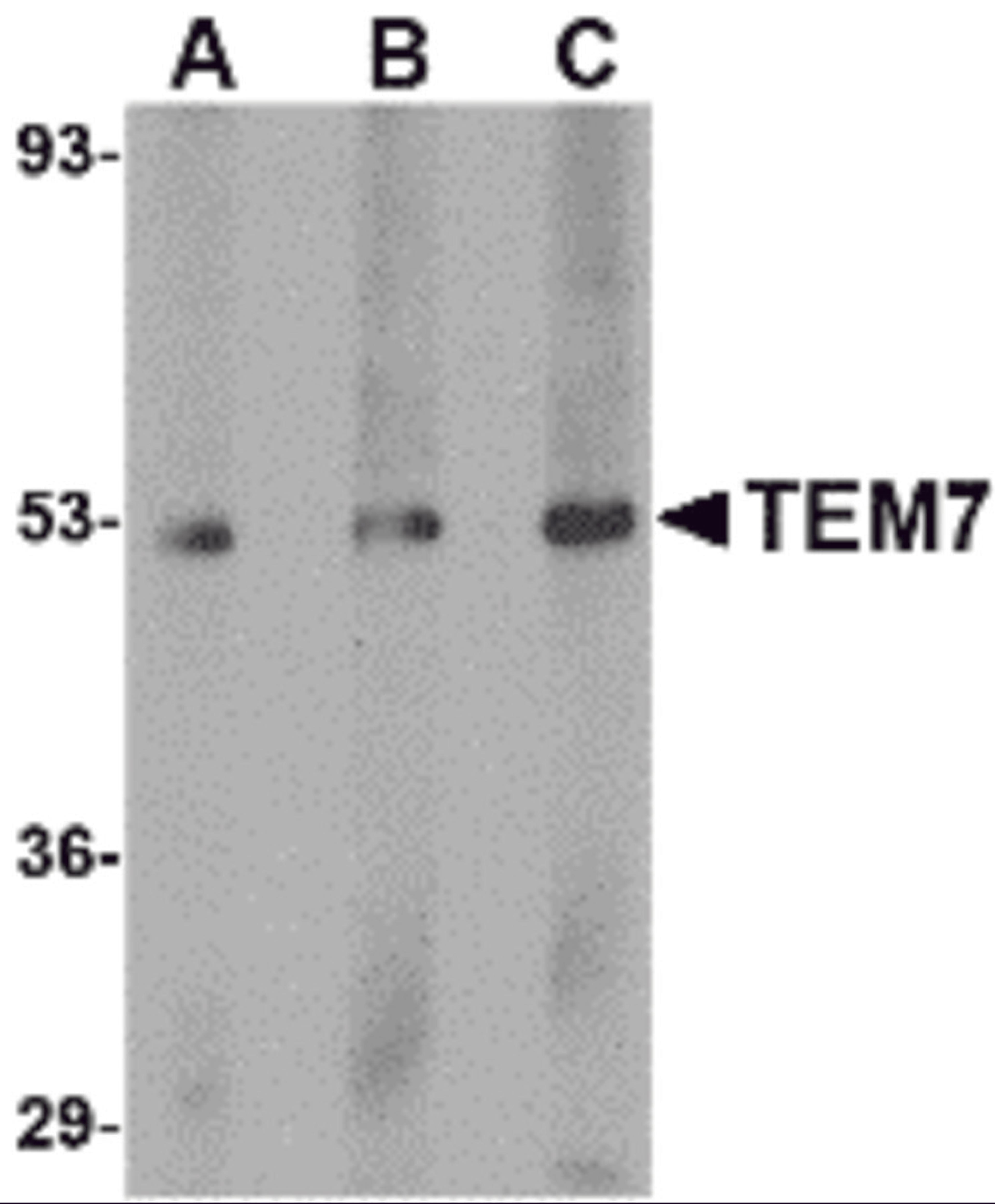 Western blot analysis of TEM7 in human liver tissue lysate with TEM7 antibody at (A) 0.5, (B) 1 and (C) 2 μg/mL.