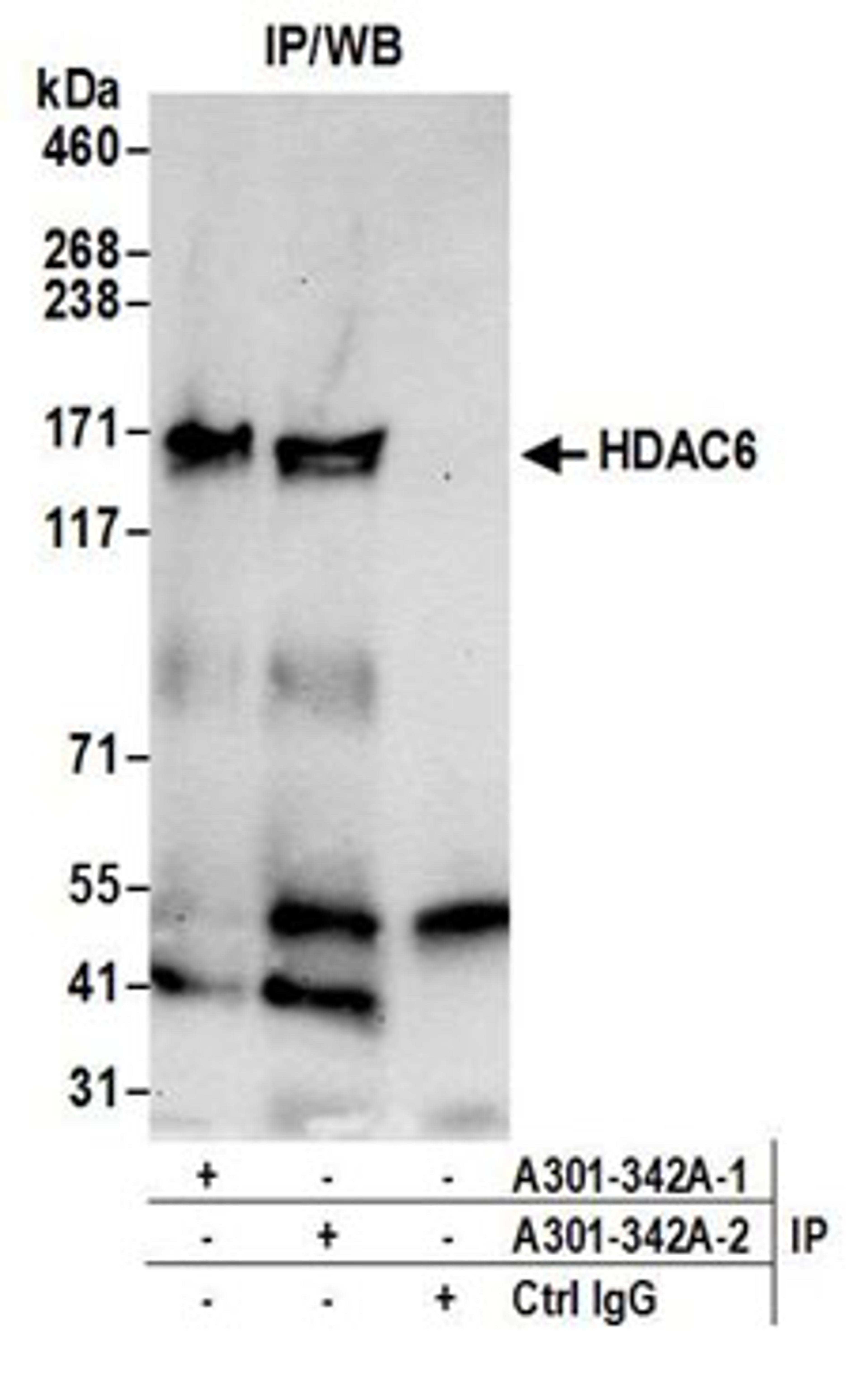 Detection of human HDAC6 by western blot of immunoprecipitates.