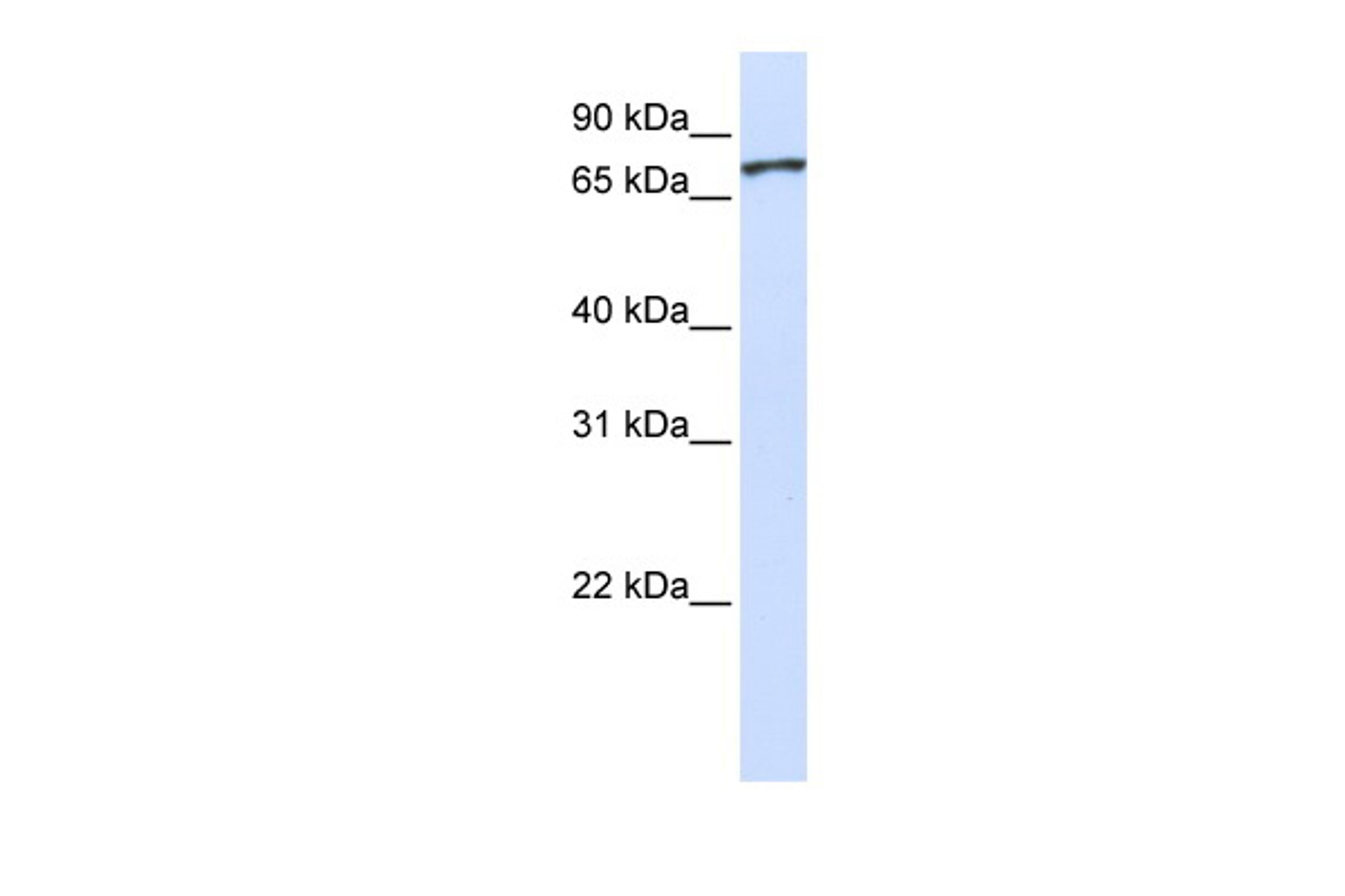 Antibody used in WB on Human HeLa at 0.2-1 ug/ml.