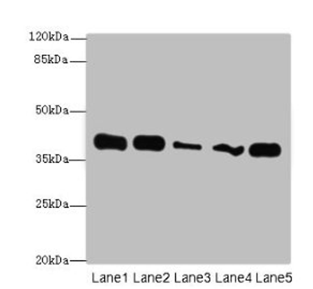 Western blot. All lanes: KHDRBS2 antibody at 7µg/ml. Lane 1: K562 whole cell lysate. Lane 2: Hela whole cell lysate. Lane 3: A431 whole cell lysate. Lane 4: Jurkat whole cell lysate. Lane 5: NIH/3T3 whole cell lysate. Secondary. Goat polyclonal to rabbit IgG at 1/10000 dilution. Predicted band size: 39 kDa. Observed band size: 39 kDa