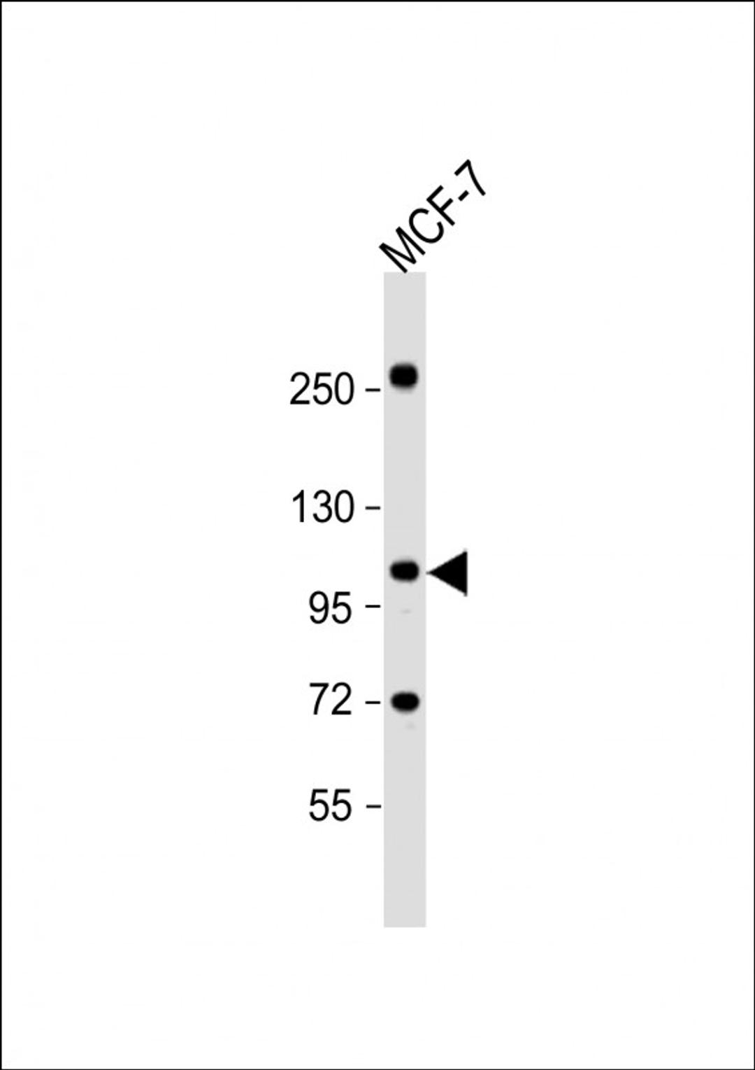 Western Blot at 1:1000 dilution + MCF-7 whole cell lysate Lysates/proteins at 20 ug per lane.