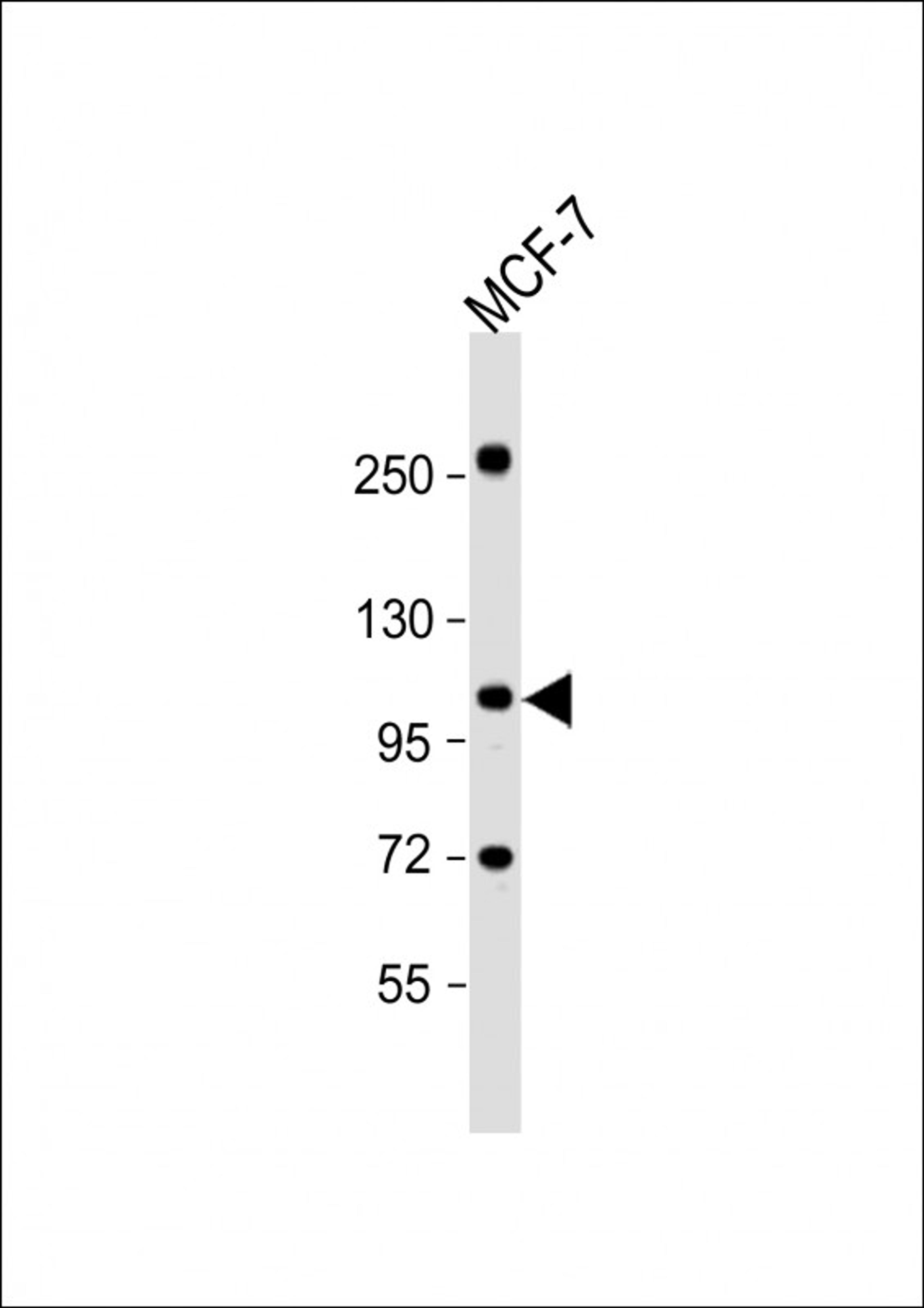 Western Blot at 1:1000 dilution + MCF-7 whole cell lysate Lysates/proteins at 20 ug per lane.