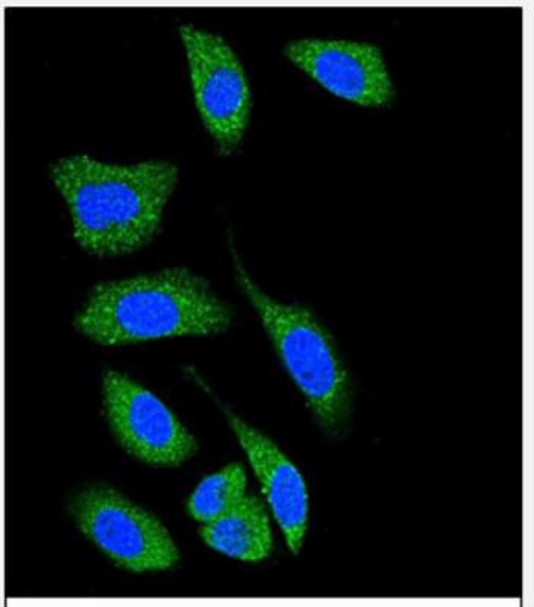 Immunocytochemistry/Immunofluorescence: DAP Kinase 1 Antibody [NBP2-30083] - Confocal immunofluorescent analysis of DAP Kinase 1 (DAPK1) Antibody (C-term) (NBP2-30083) with A549 cell followed by Alexa Fluor 489-conjugated goat anti-rabbit lgG (green). DAPI was used to stain the cell nuclear (blue).