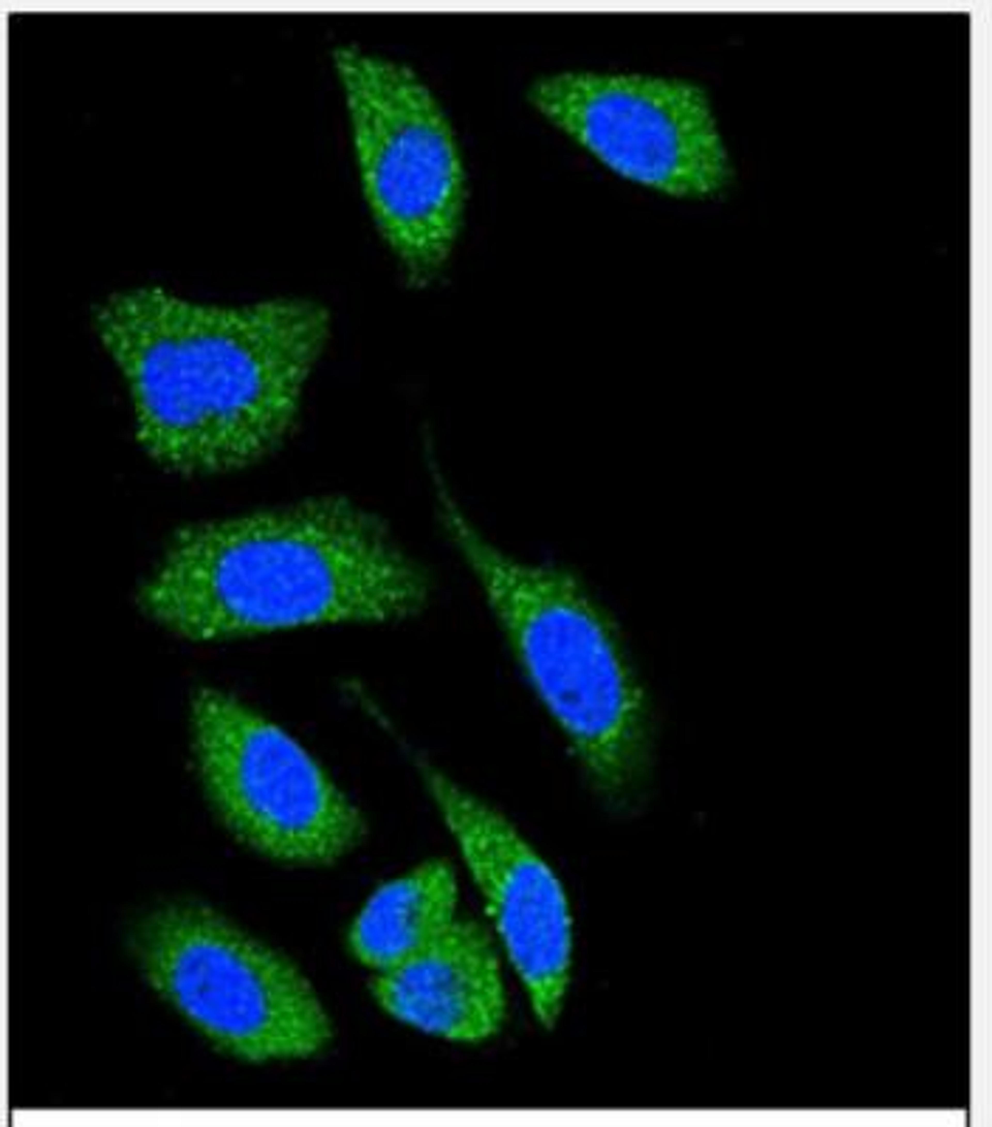 Immunocytochemistry/Immunofluorescence: DAP Kinase 1 Antibody [NBP2-30083] - Confocal immunofluorescent analysis of DAP Kinase 1 (DAPK1) Antibody (C-term) (NBP2-30083) with A549 cell followed by Alexa Fluor 489-conjugated goat anti-rabbit lgG (green). DAPI was used to stain the cell nuclear (blue).