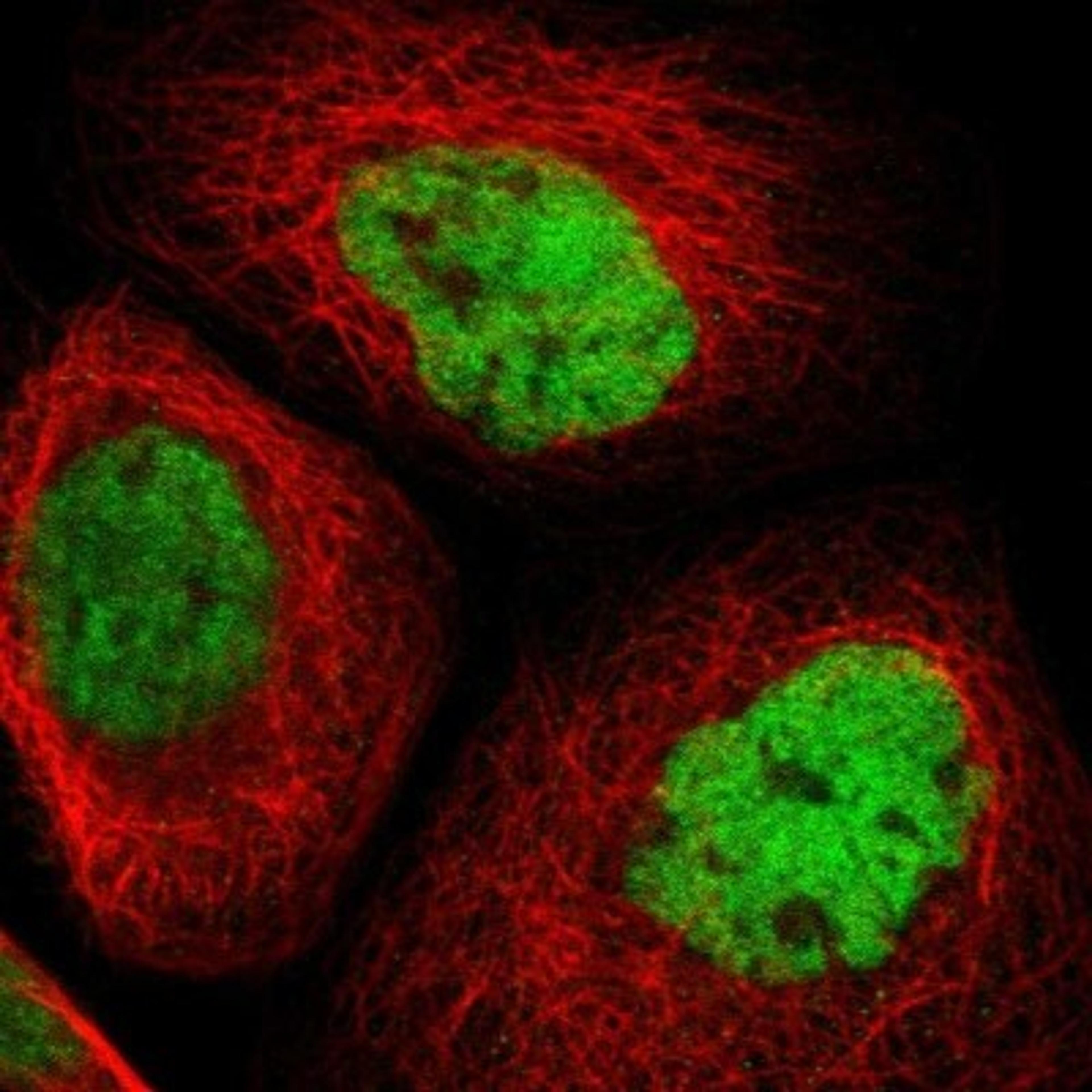 Immunocytochemistry/Immunofluorescence: YBEY Antibody [NBP1-89877] - Staining of human cell line A-431 shows positivity in nucleus but not nucleoli.