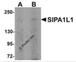 Western blot analysis of SIPA1L1 in rat brain tissue lysate with SIPA1L1 antibody at (A) 0.5 and (B) 1 &#956;g/mL.