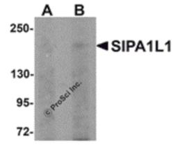 Western blot analysis of SIPA1L1 in rat brain tissue lysate with SIPA1L1 antibody at (A) 0.5 and (B) 1 μg/mL.