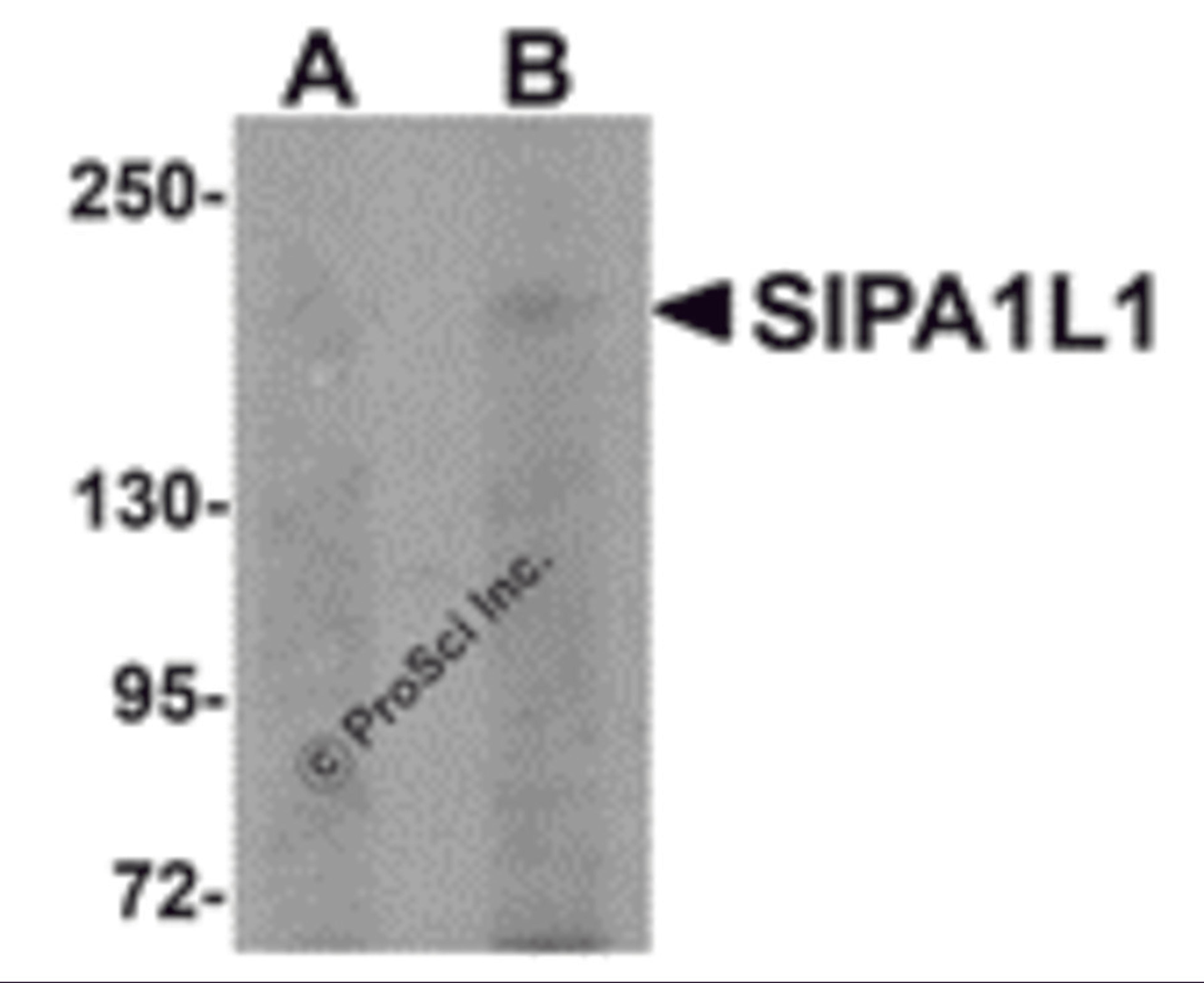 Western blot analysis of SIPA1L1 in rat brain tissue lysate with SIPA1L1 antibody at (A) 0.5 and (B) 1 μg/mL.