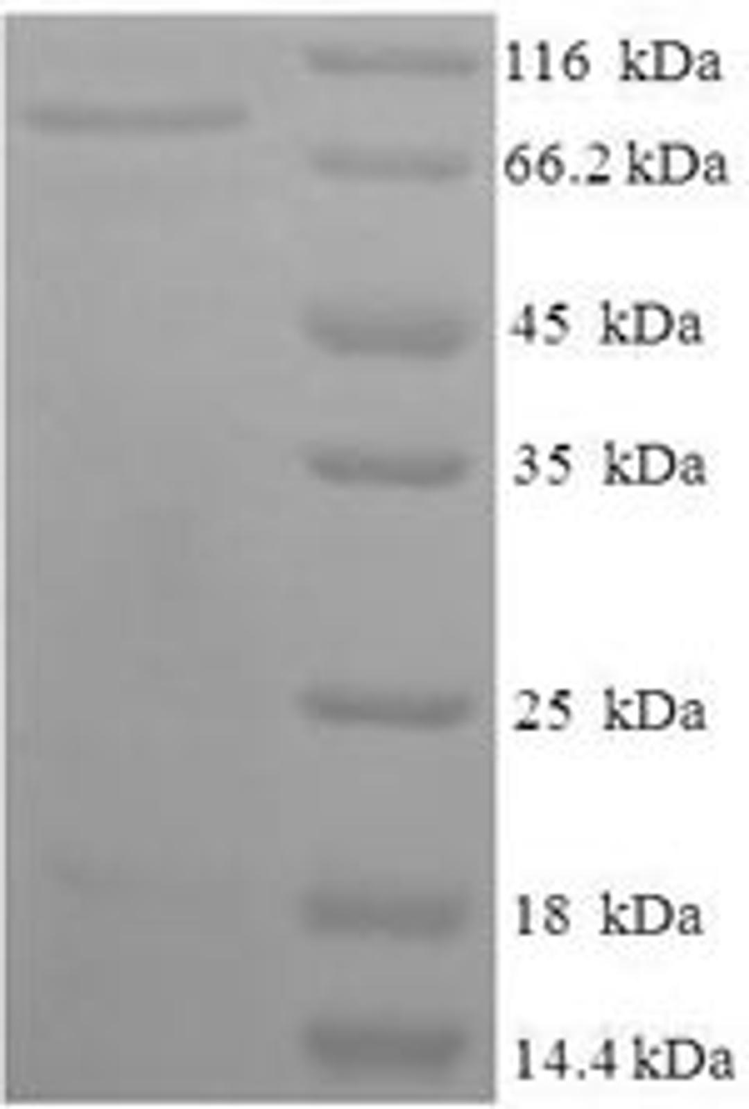(Tris-Glycine gel) Discontinuous SDS-PAGE (reduced) with 5% enrichment gel and 15% separation gel.