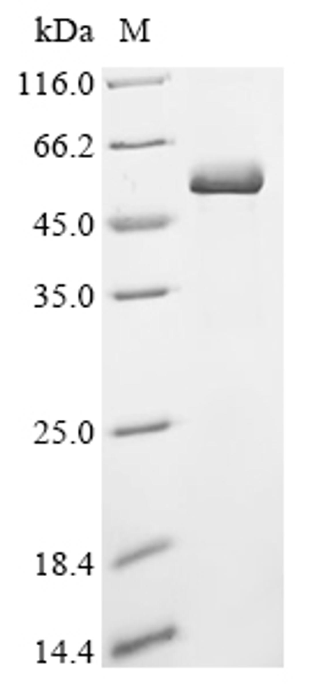 (Tris-Glycine gel) Discontinuous SDS-PAGE (reduced) with 5% enrichment gel and 15% separation gel.