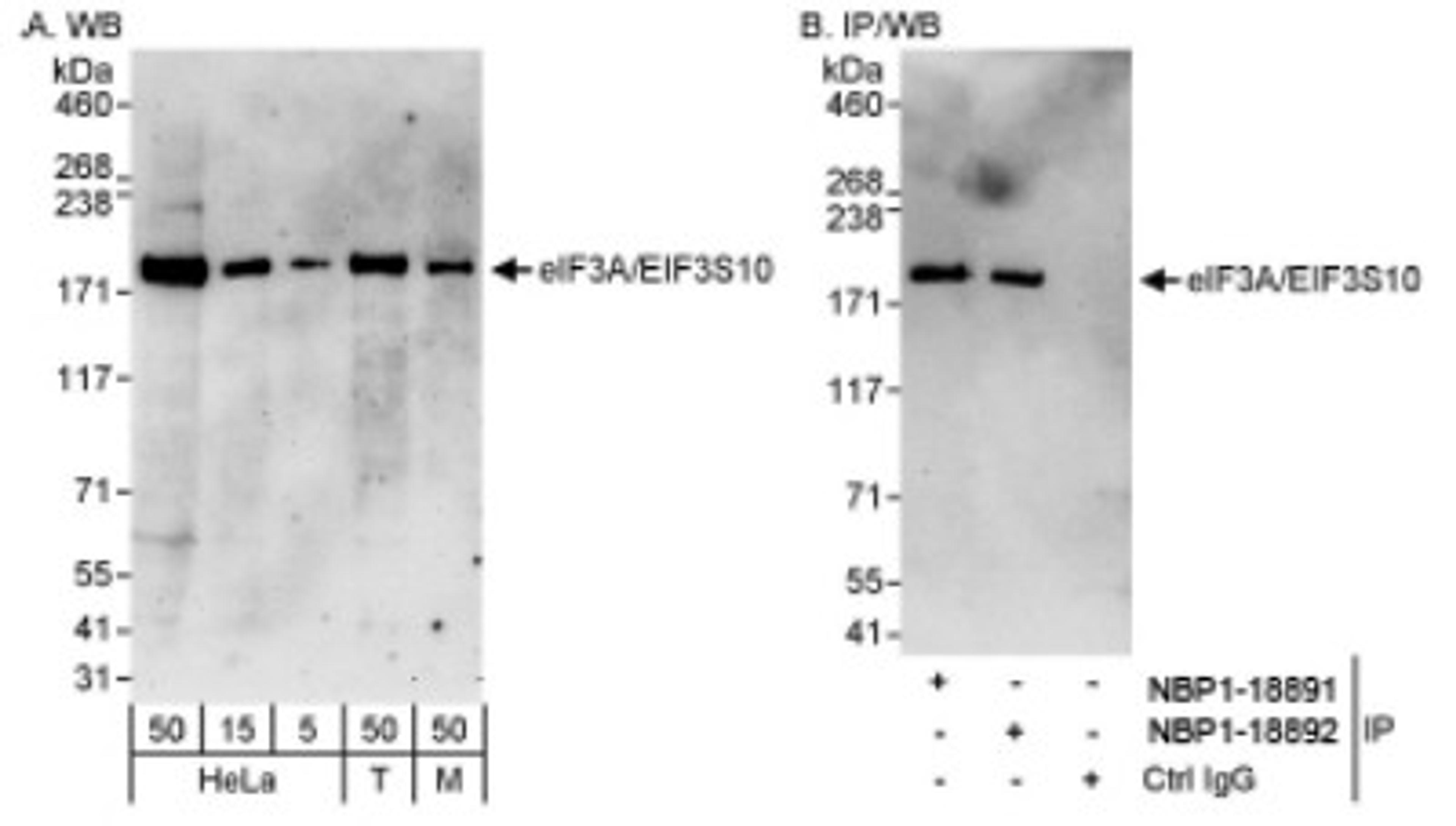 Western Blot: EIF3A Antibody [NBP1-18891] - Whole cell lysate from HeLa, 293T and mouse NIH3T3 cells. eIF3A/EIF3S10 was also immunoprecipitated by rabbit antieIF3A/ EIF3S10 antibody NBP1-18892.