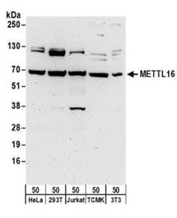 Detection of human and mouse METTL16 by western blot.