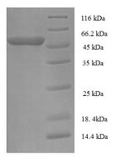 (Tris-Glycine gel) Discontinuous SDS-PAGE (reduced) with 5% enrichment gel and 15% separation gel.