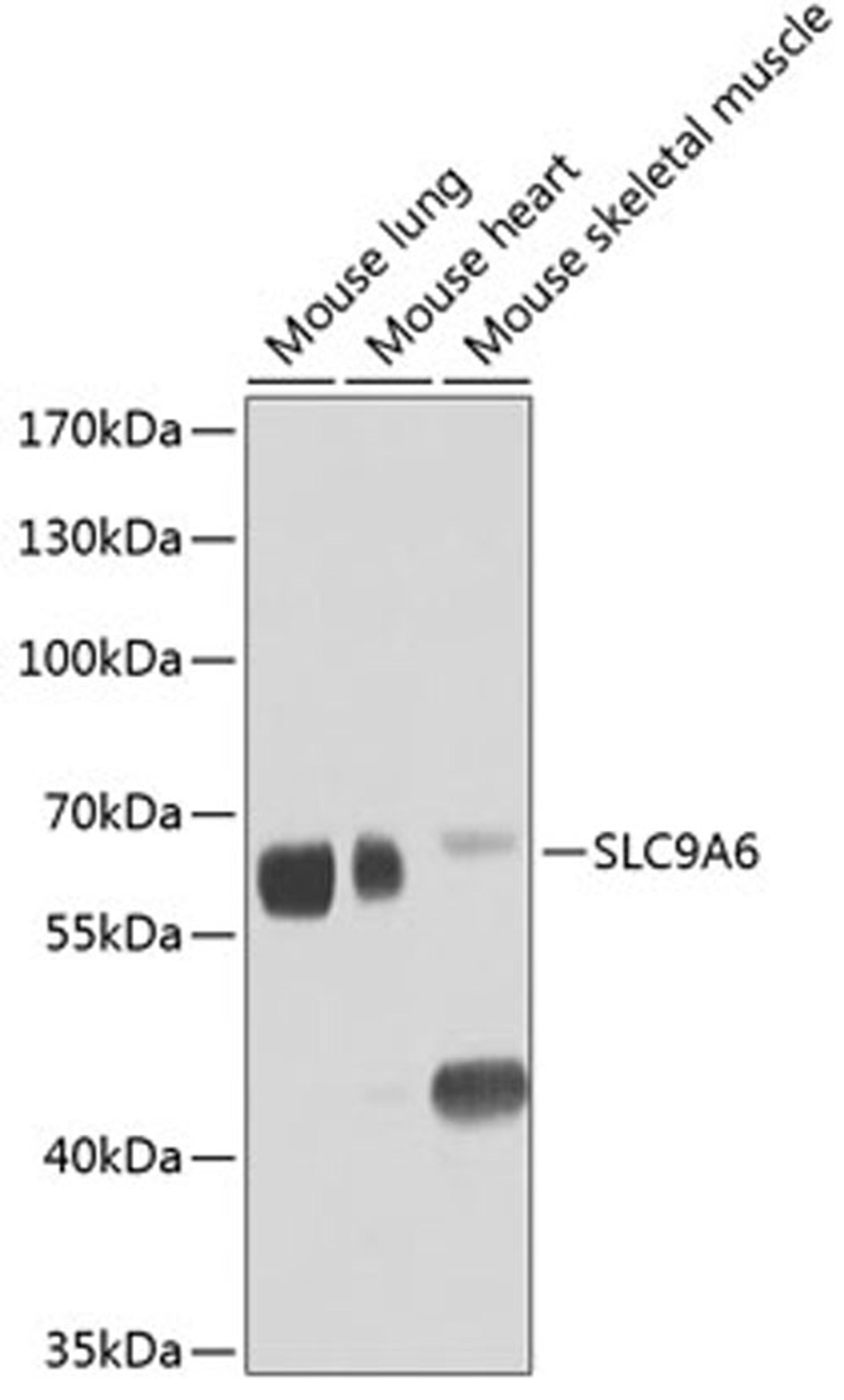 Western blot - SLC9A6 antibody (A8187)